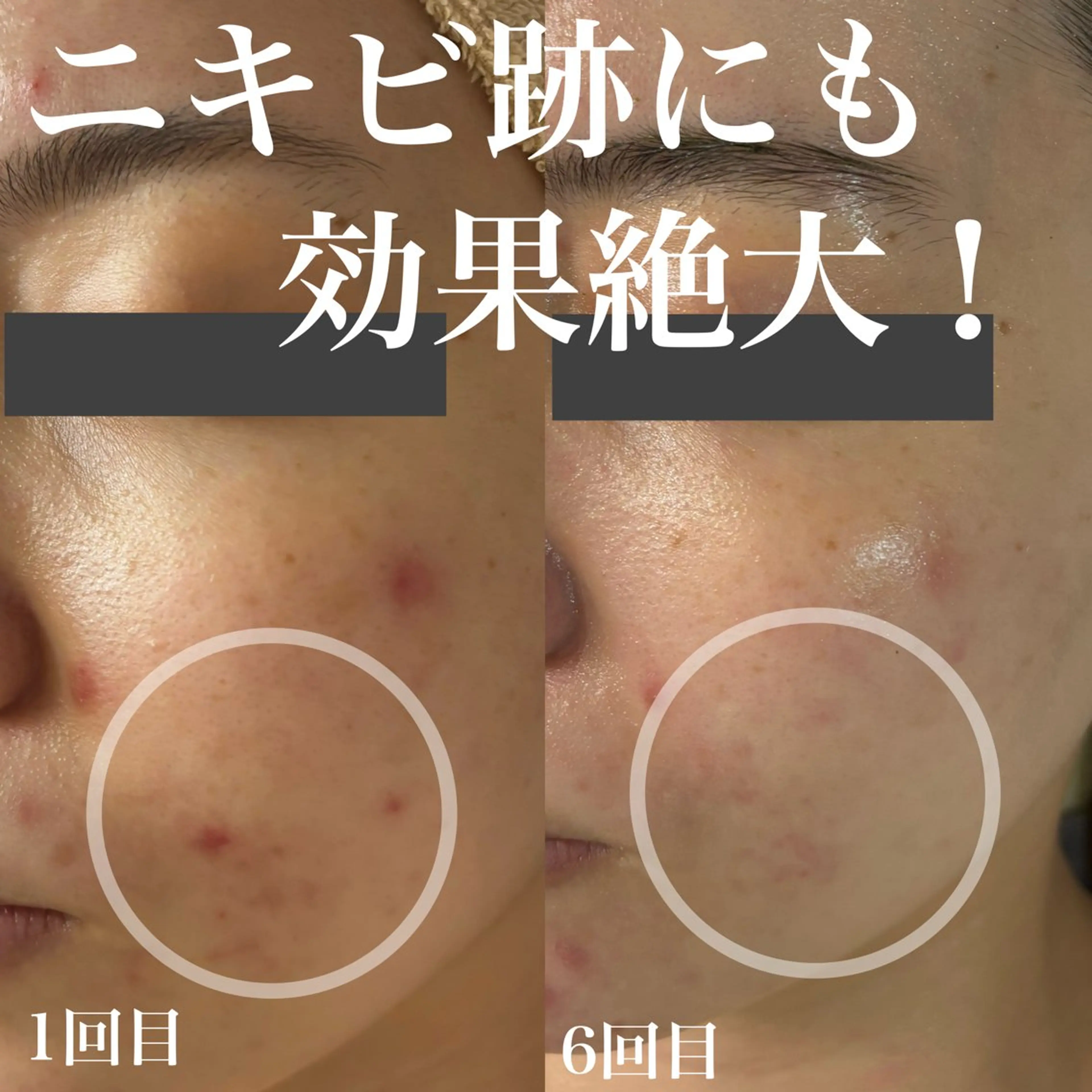 エステ WHITE AQUA 北千住店のエステ・リラクイメージ