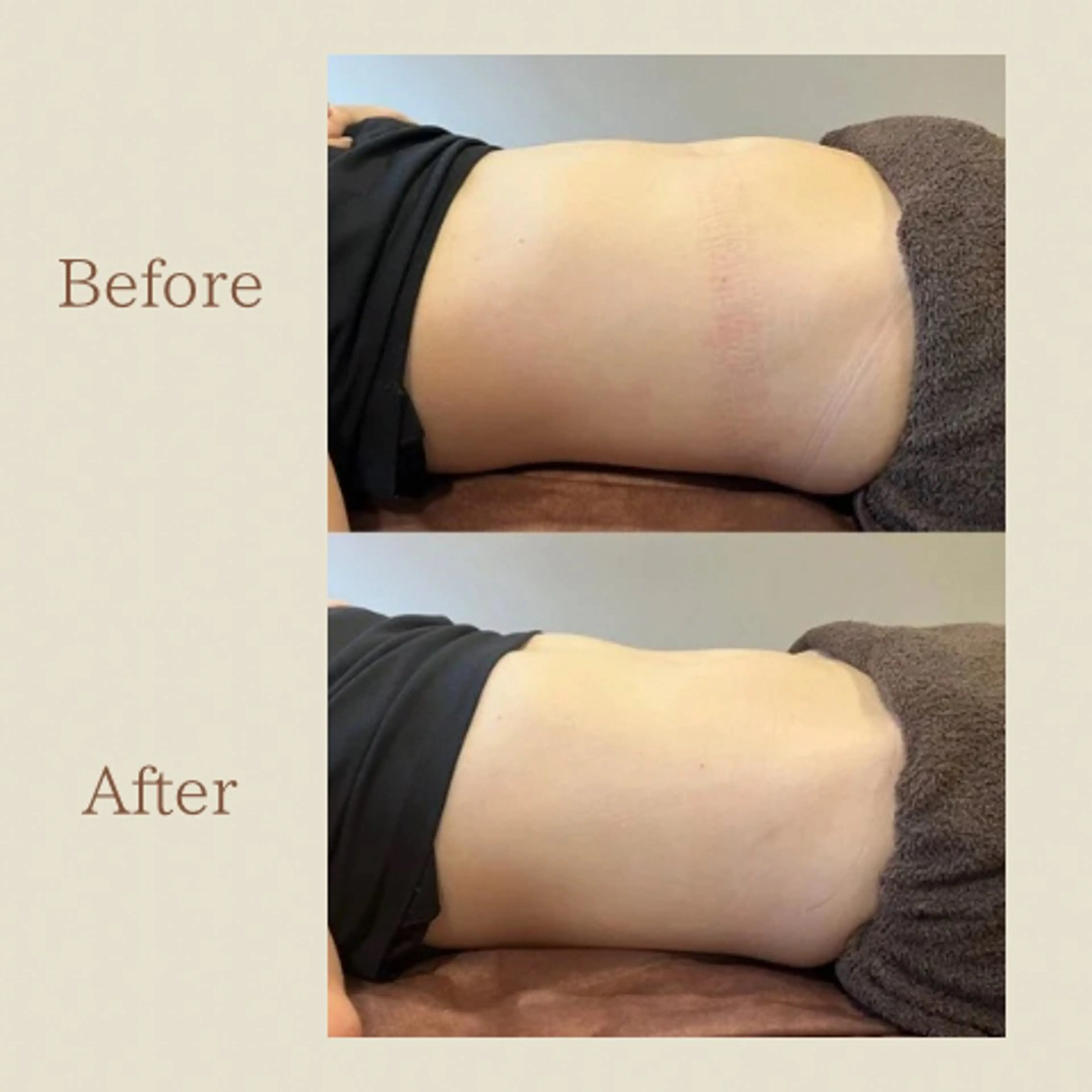 お腹痩せエステ Flat BELLY 恵比寿所属・【腸もみ/脂肪冷却】 お腹エステ/恵比寿のエステ・リラクイメージ