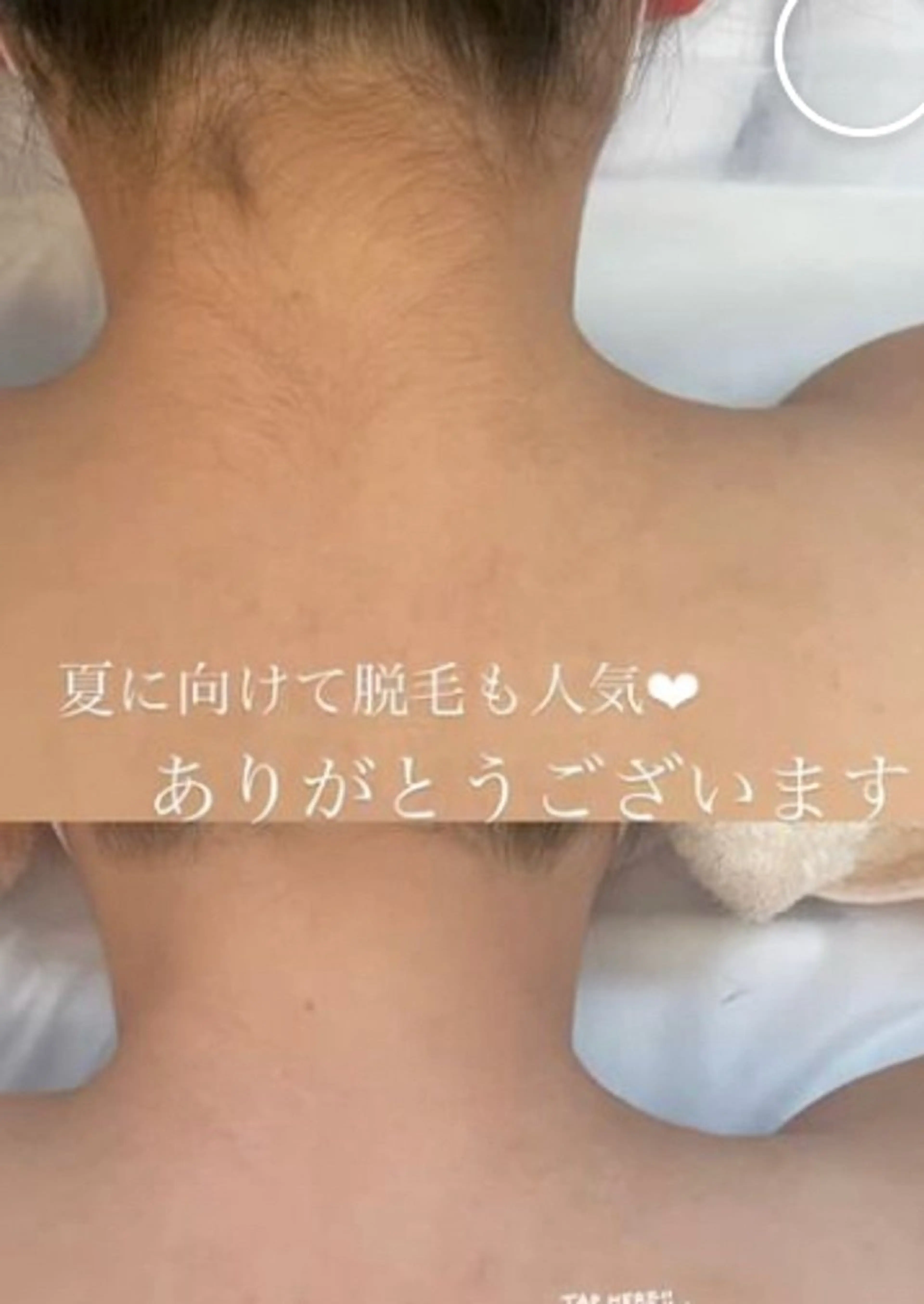 脱毛 Luana ∞のエステ・リラクイメージ