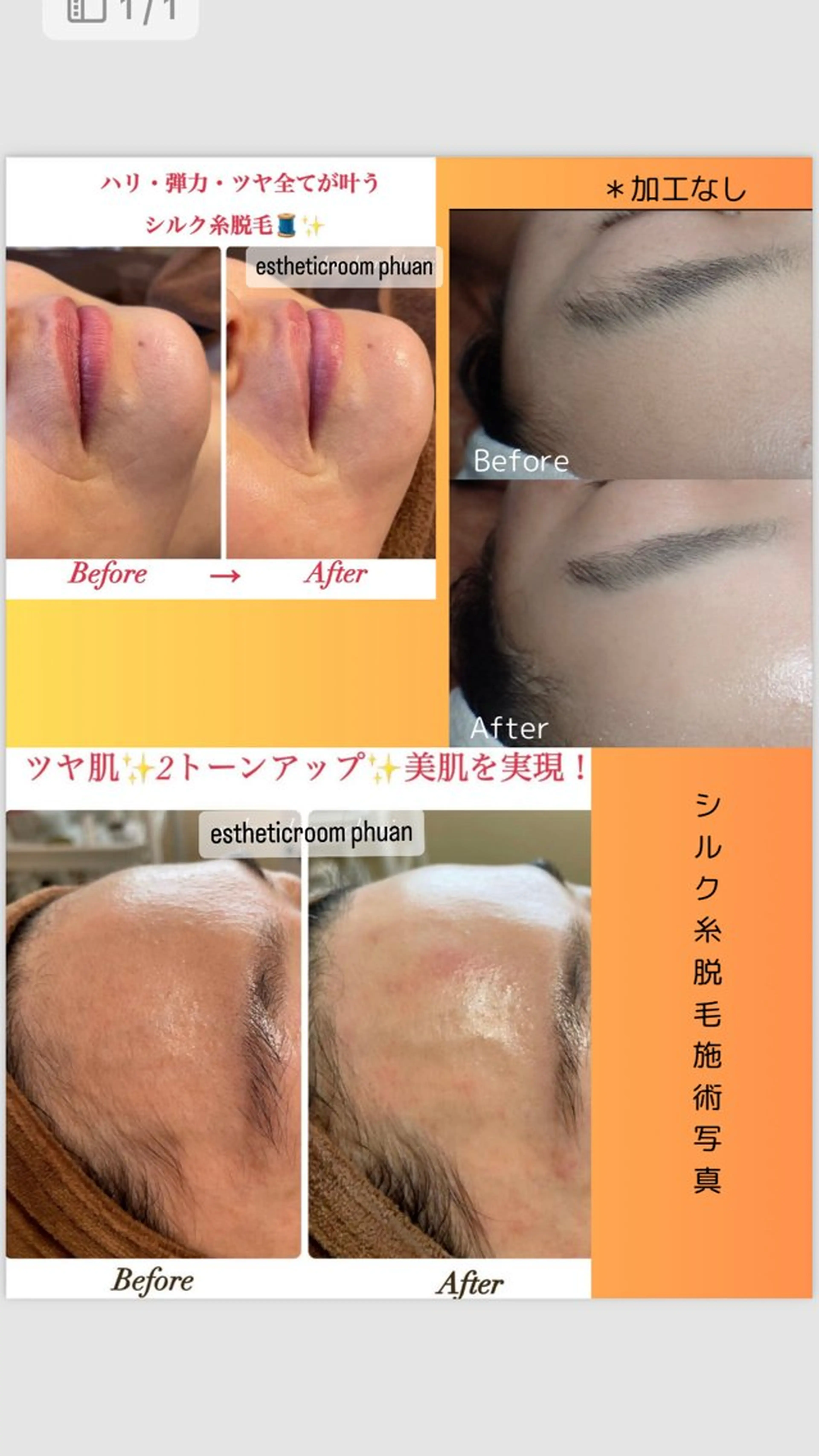 エステ 肌質改善/ピーリング phuan(プアン)のその他イメージ
