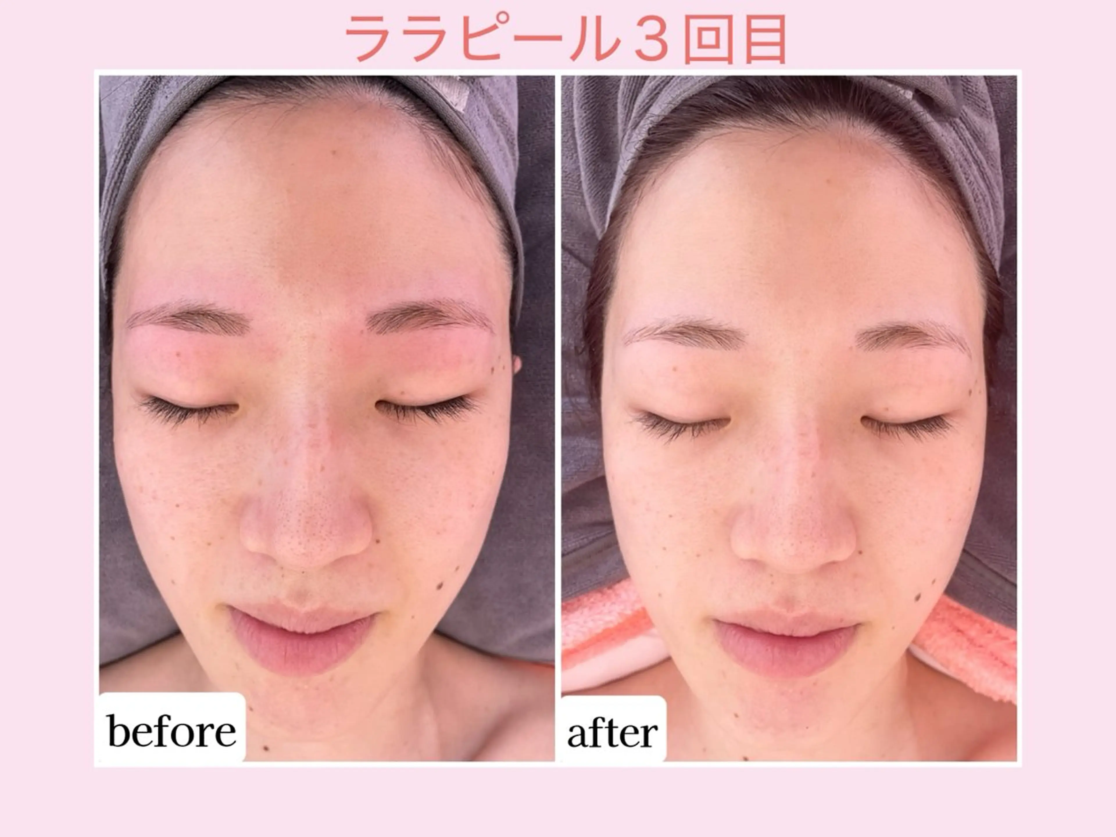 その他 Karen Private Spa所属・💜Karen PrivateSpaのエステ・リラクイメージ