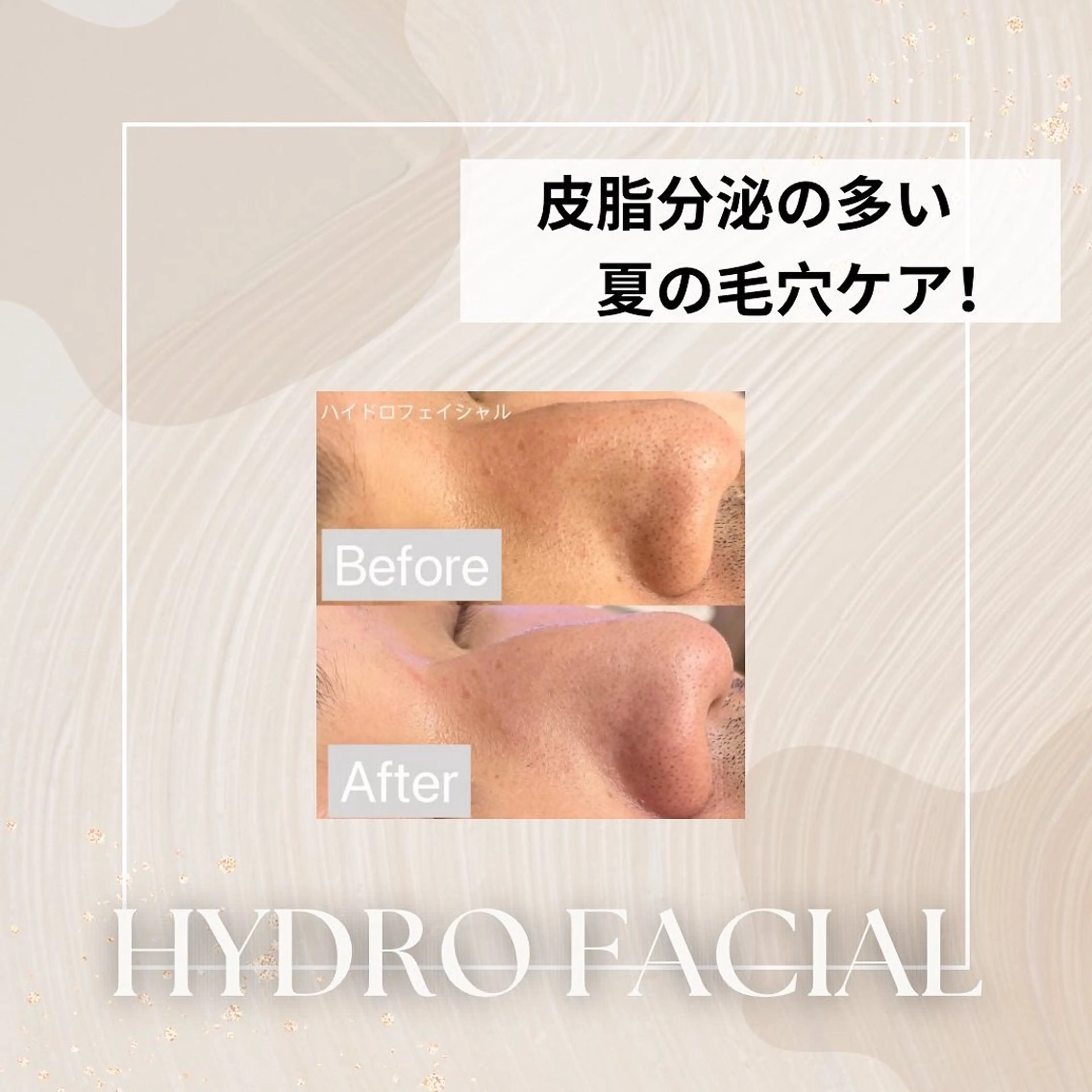 エステ アイラッシュ&エステサロンLinda西宮所属・小顔&肌質改善 LINDA西宮 AIのエステ・リラクイメージ