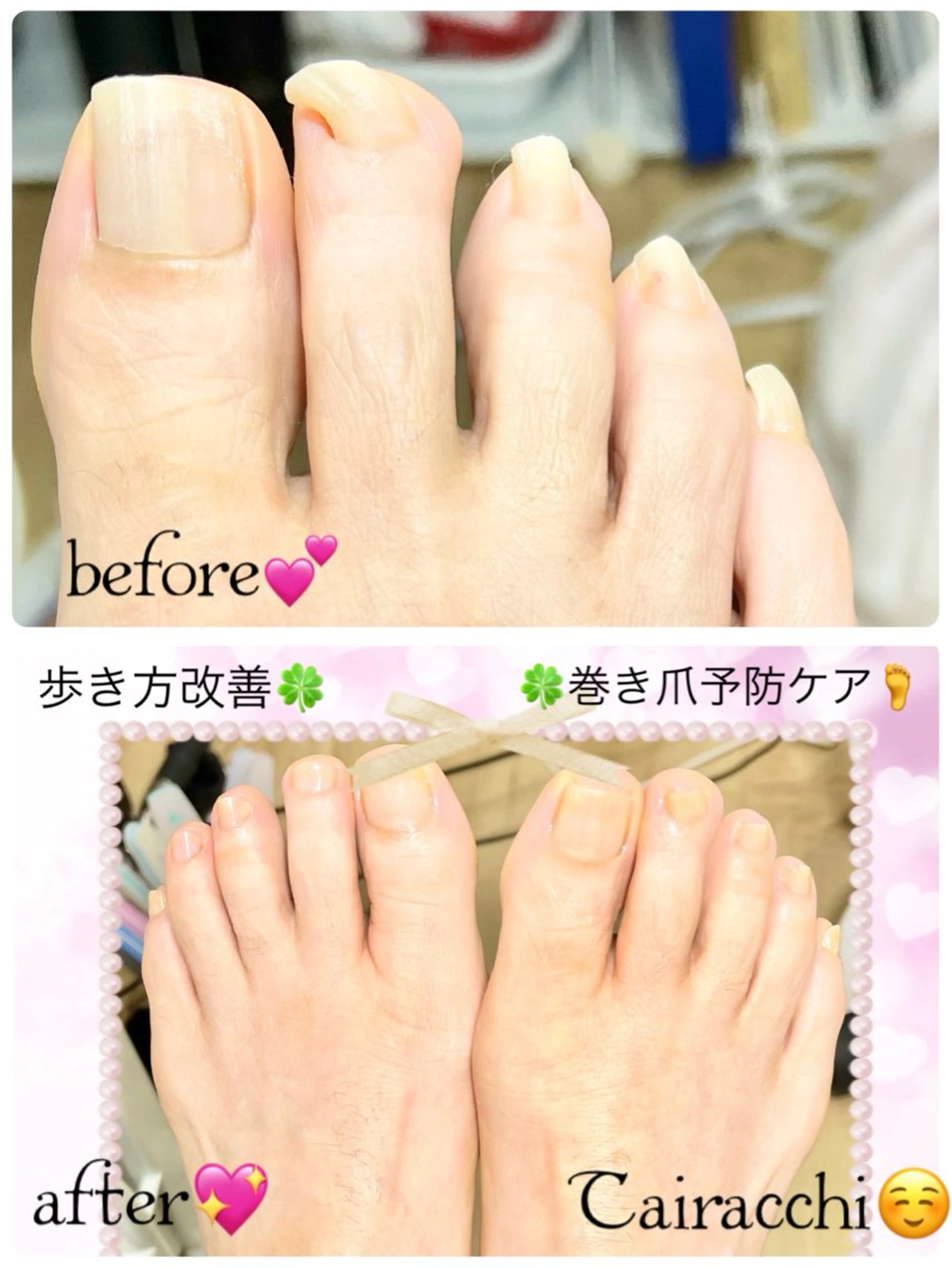 ネイル フットネイル Tairacchi ﾀｲﾗｯﾁのネイルデザイン