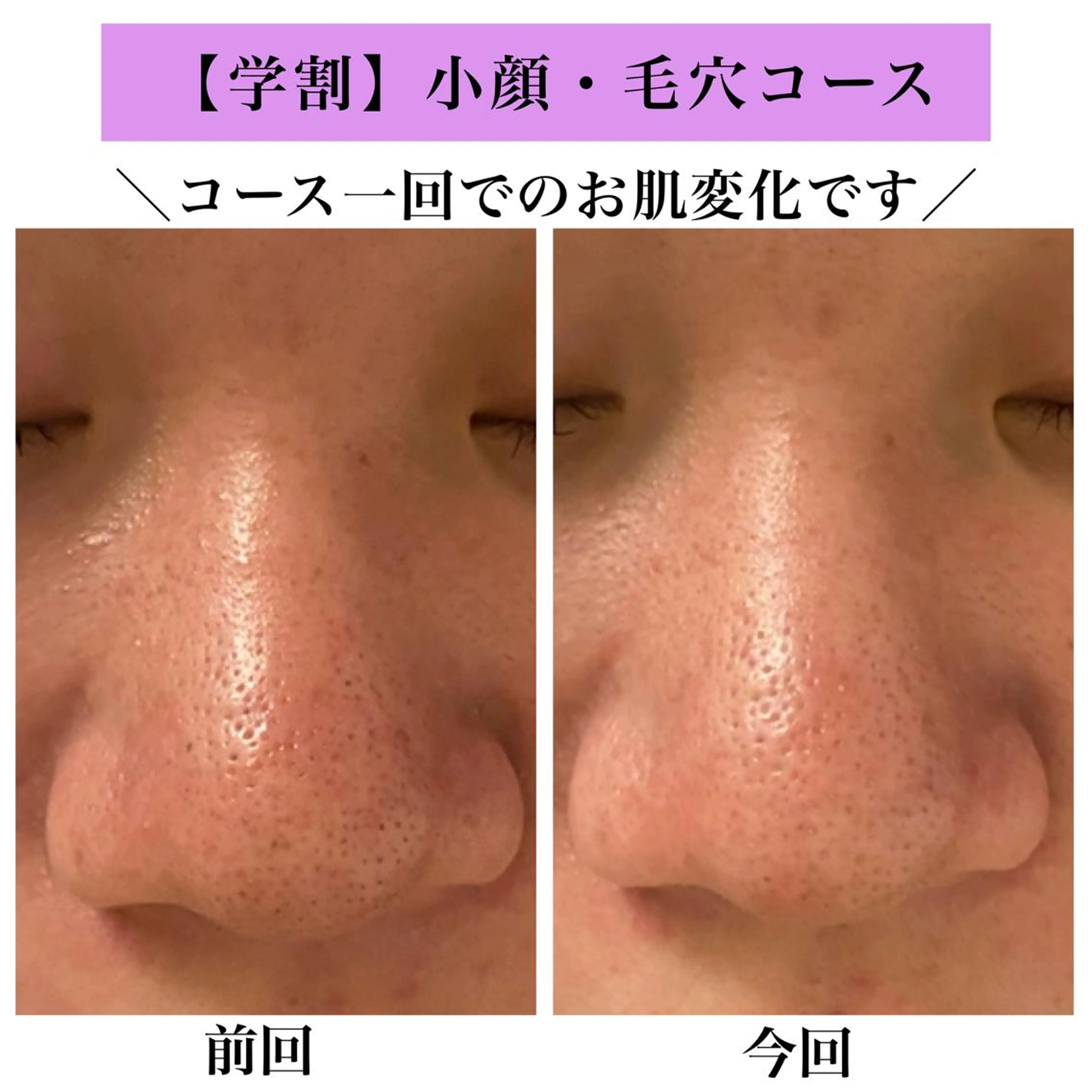 Bellesthe (ベルエステ)のエステ・リラクイメージ