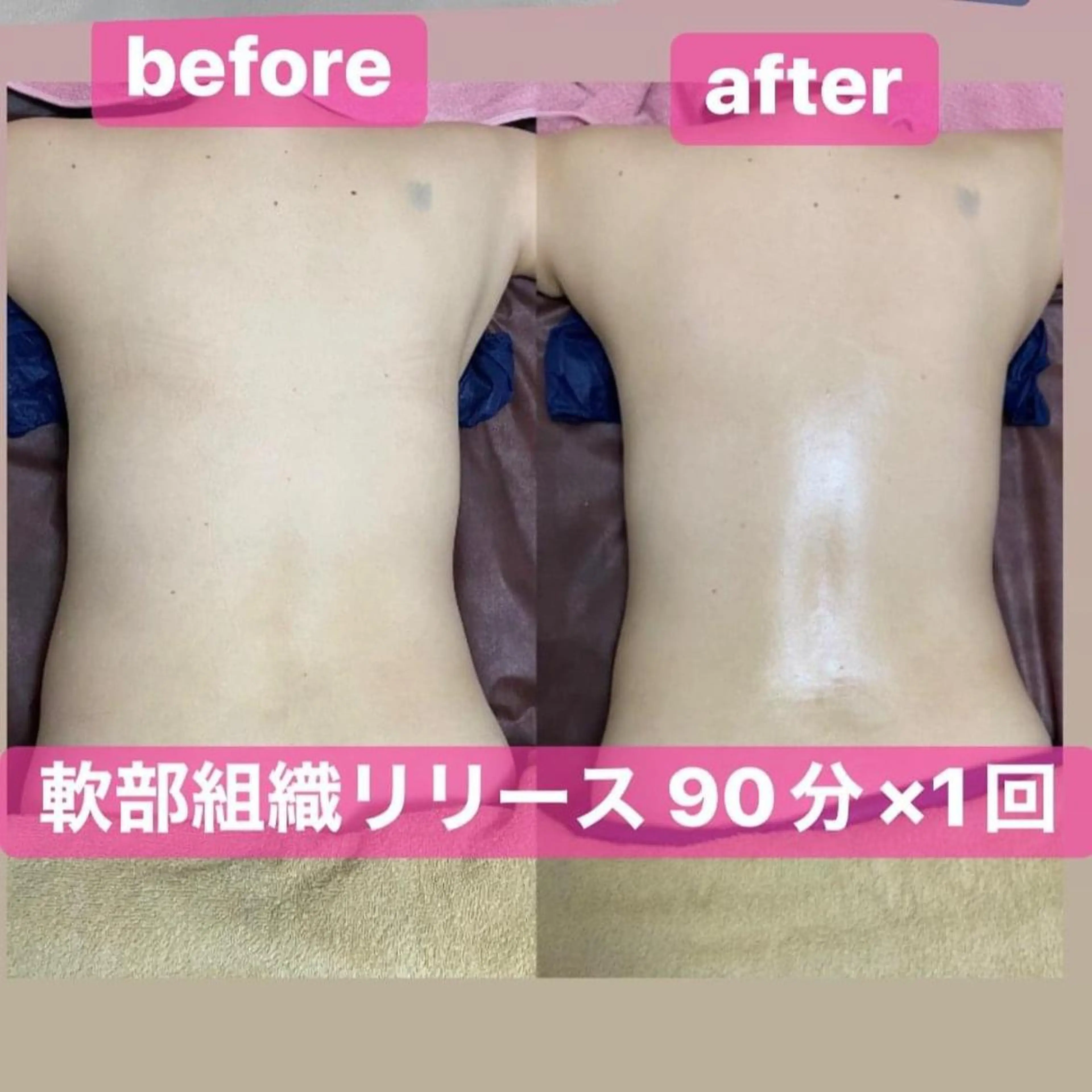 【背中ガチガチさんへ】集中メンテナンスコースの写真