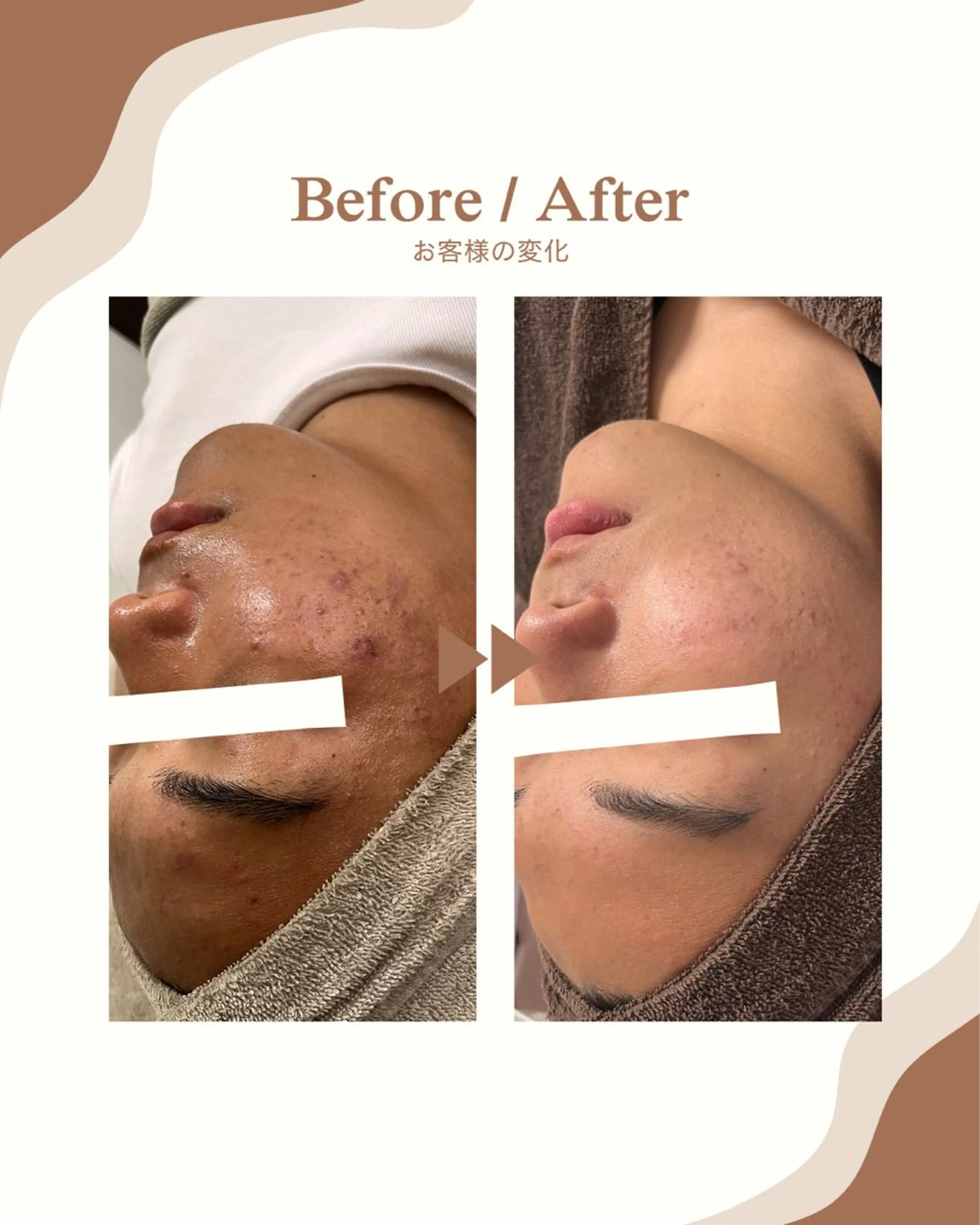 エステ 1st｜フェイシャル エステ専門店のエステ・リラクイメージ