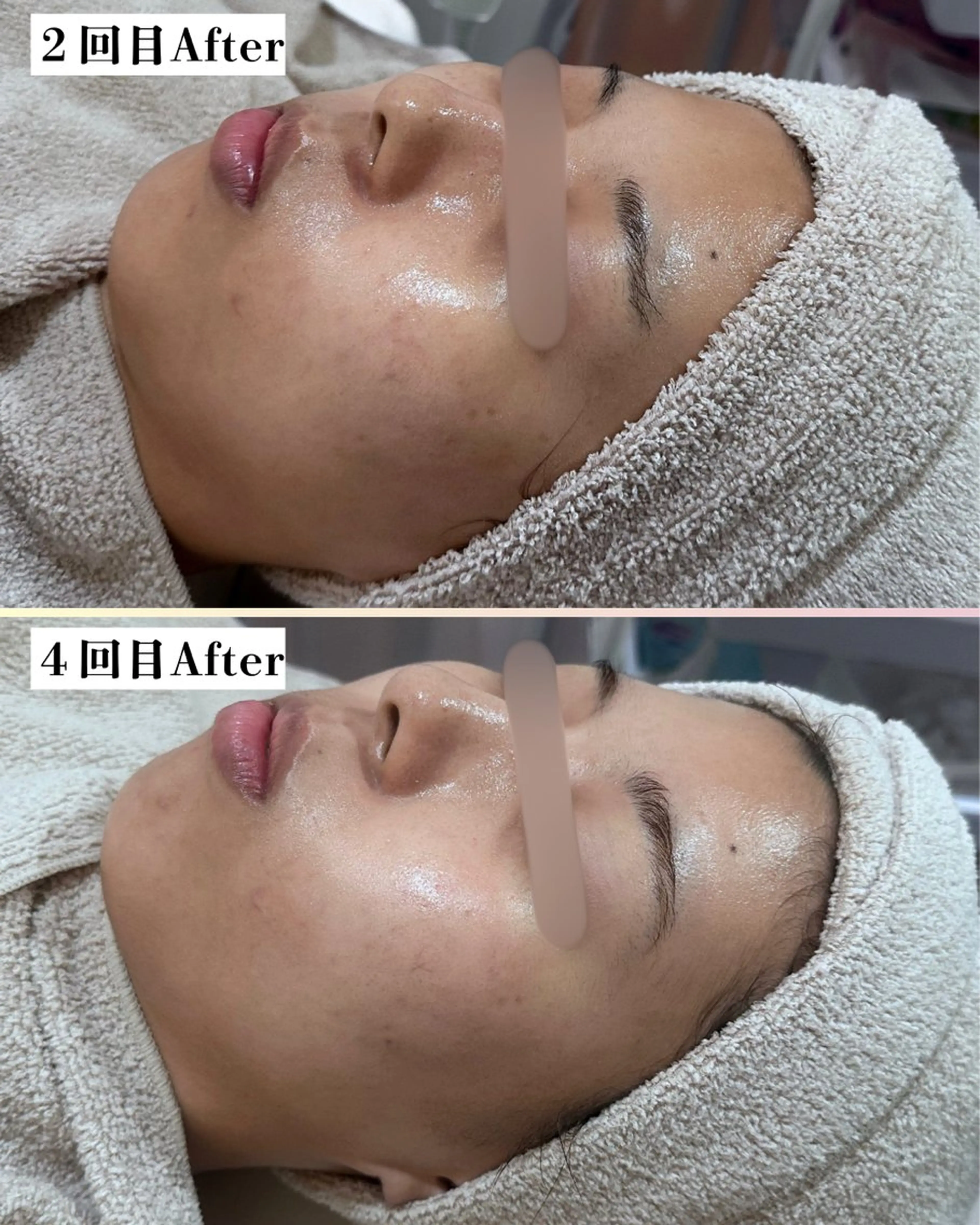 エステ s o i n a🤍🪽ララピール/毛穴/小顔/水光肌所属・s o i n a 神楽坂のエステ・リラクイメージ