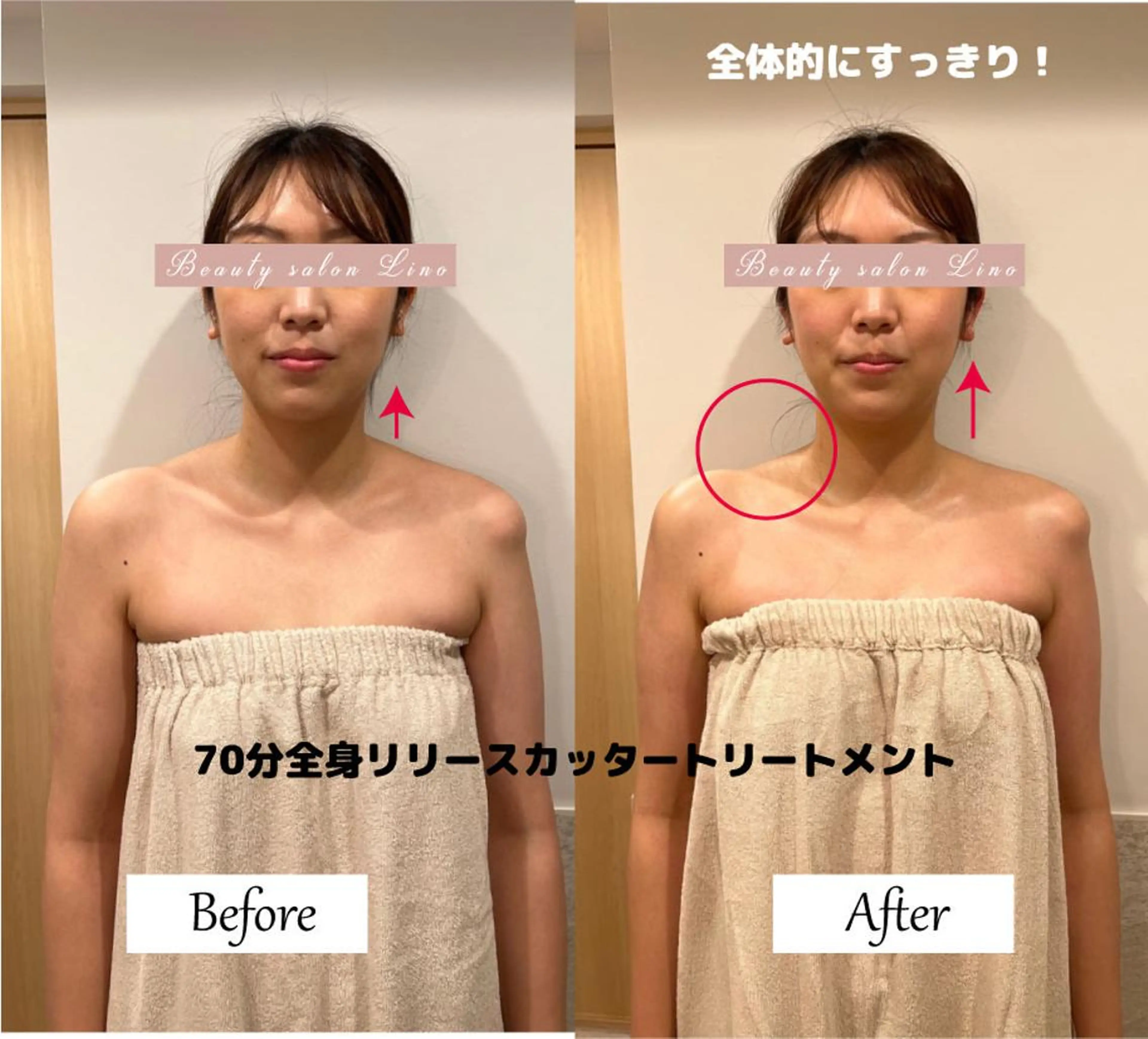 肩こり改善 筋膜リリースカッターのエステ・リラクイメージ