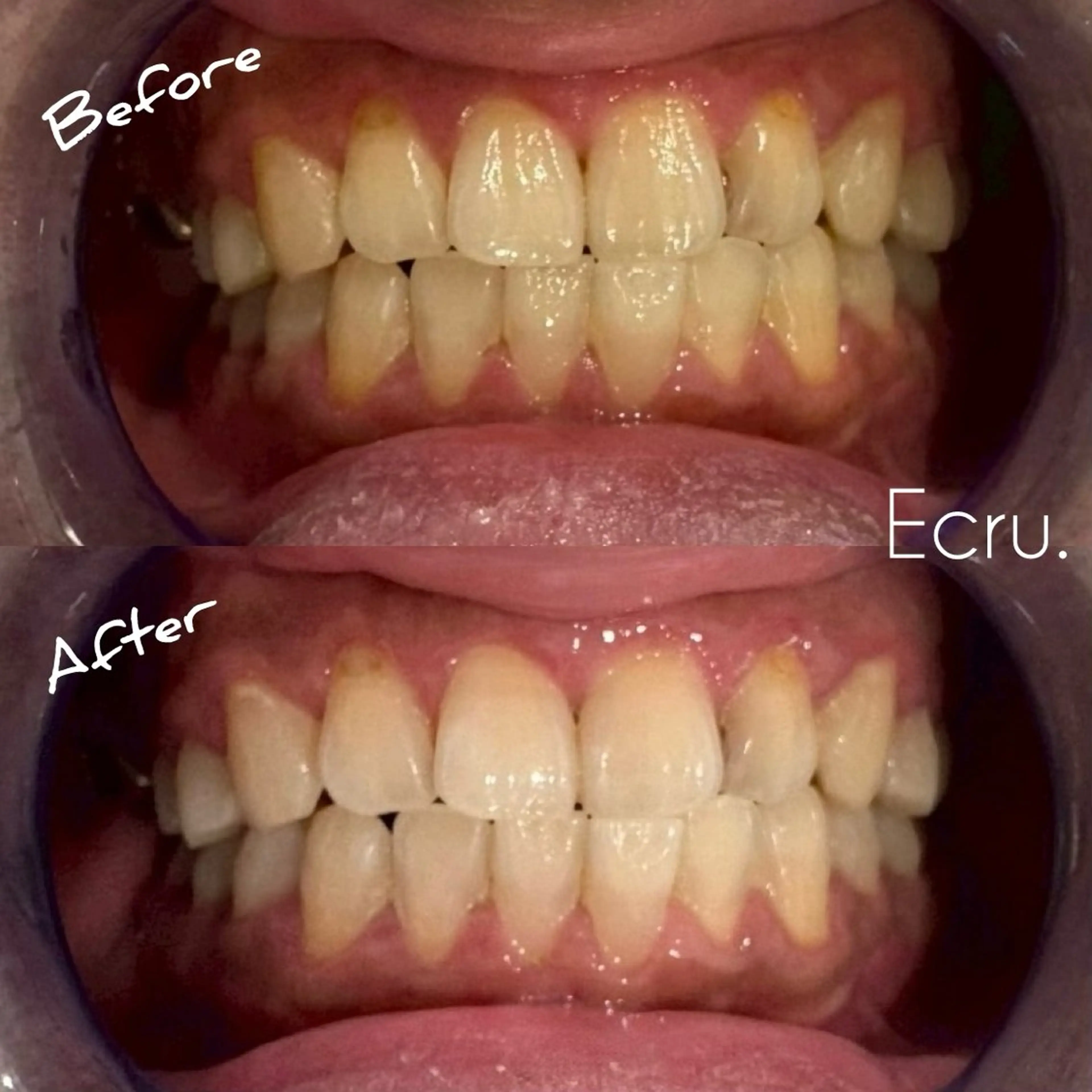 メンズ キッズ その他 ホワイトニングサロン Ecru所属・ホワイトニングサロン Ecru エクリュのその他イメージ