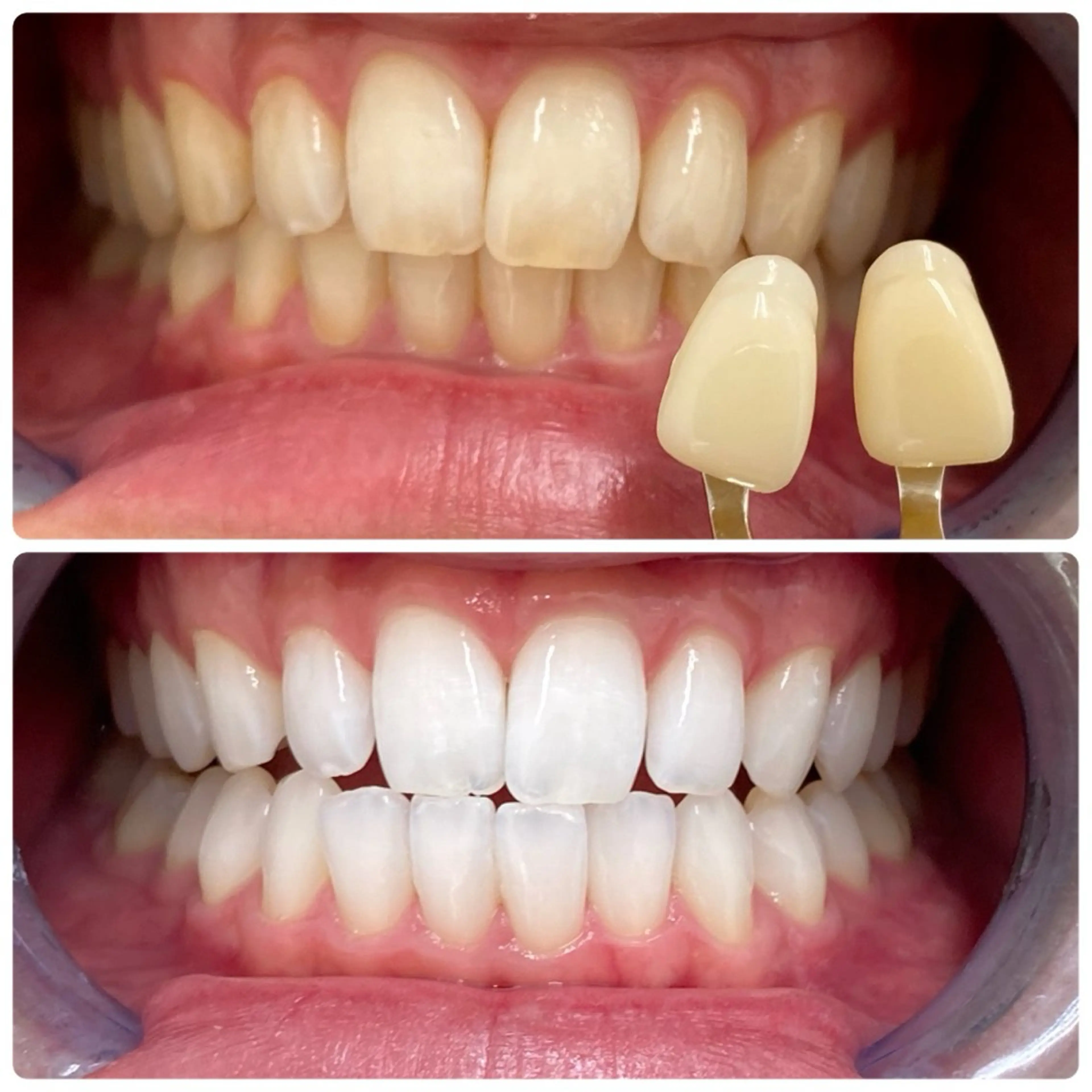 エステ cona whitening神保町所属・杉村 彩音のエステ・リラクイメージ