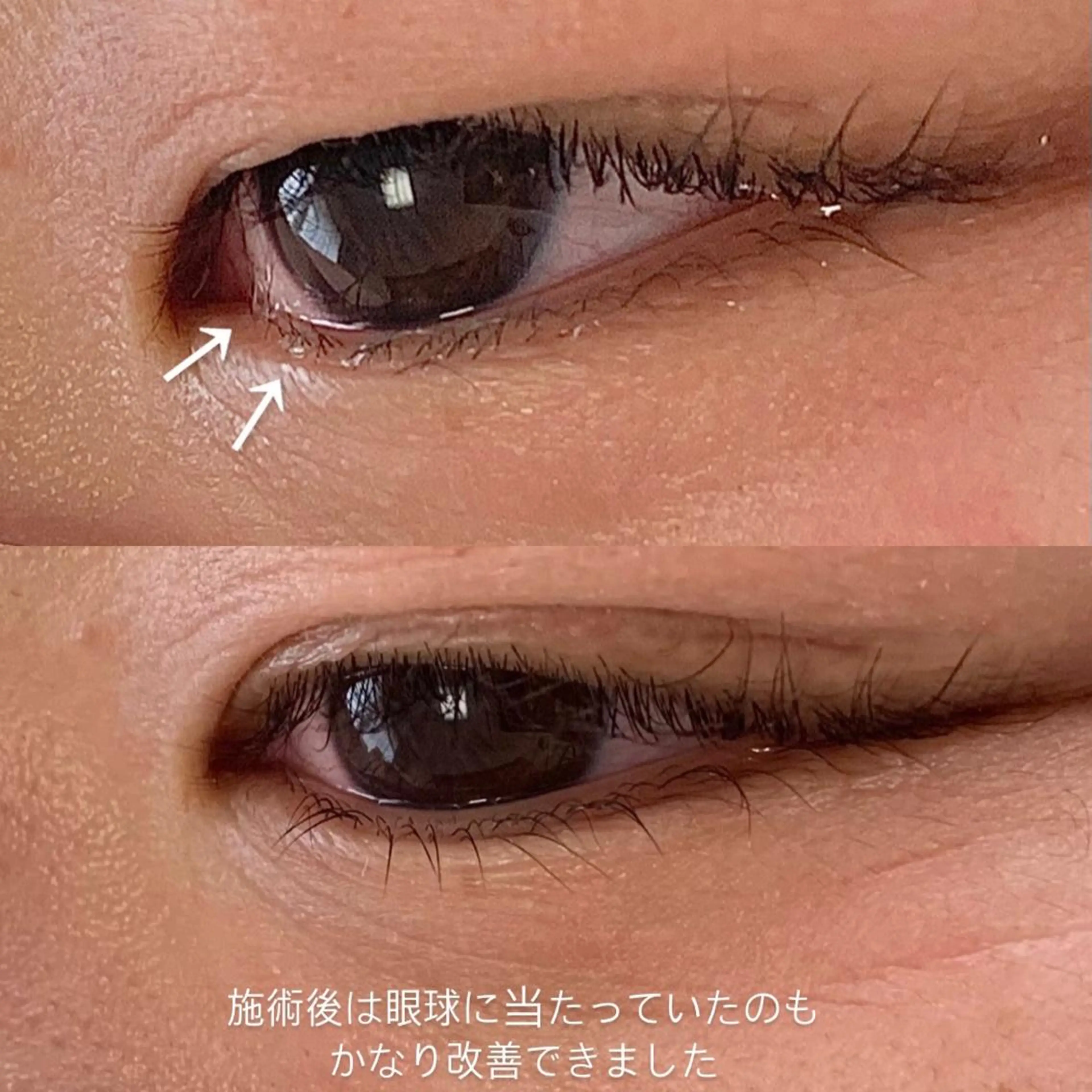 キッズ マツエク・マツパ マツパ salonLADYSTYLE所属・稲嶺 美華のエステ・リラクイメージ