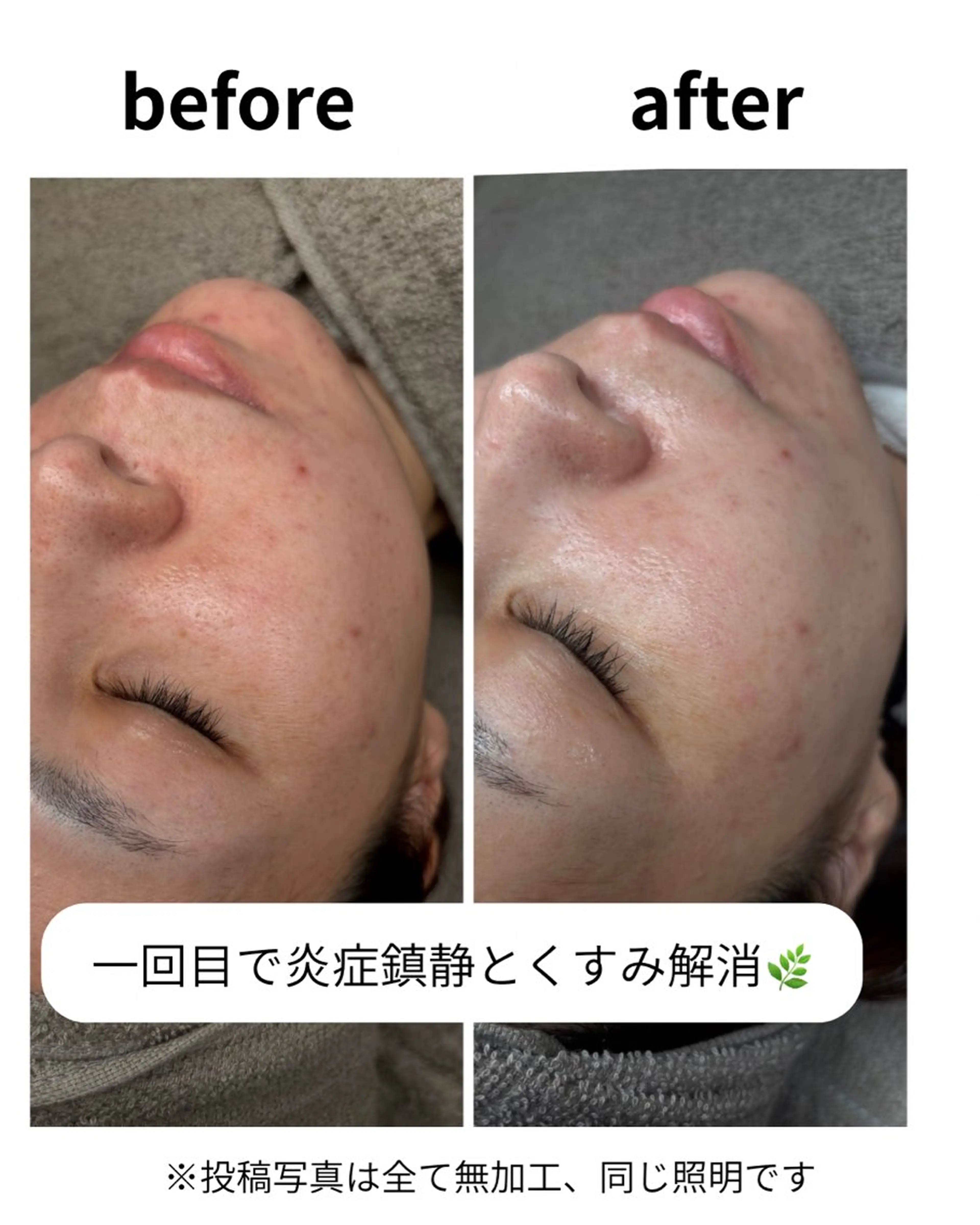 その他 Salon【yuzu.】所属・🍊肌管理×美眉 【yuzu.】のその他イメージ