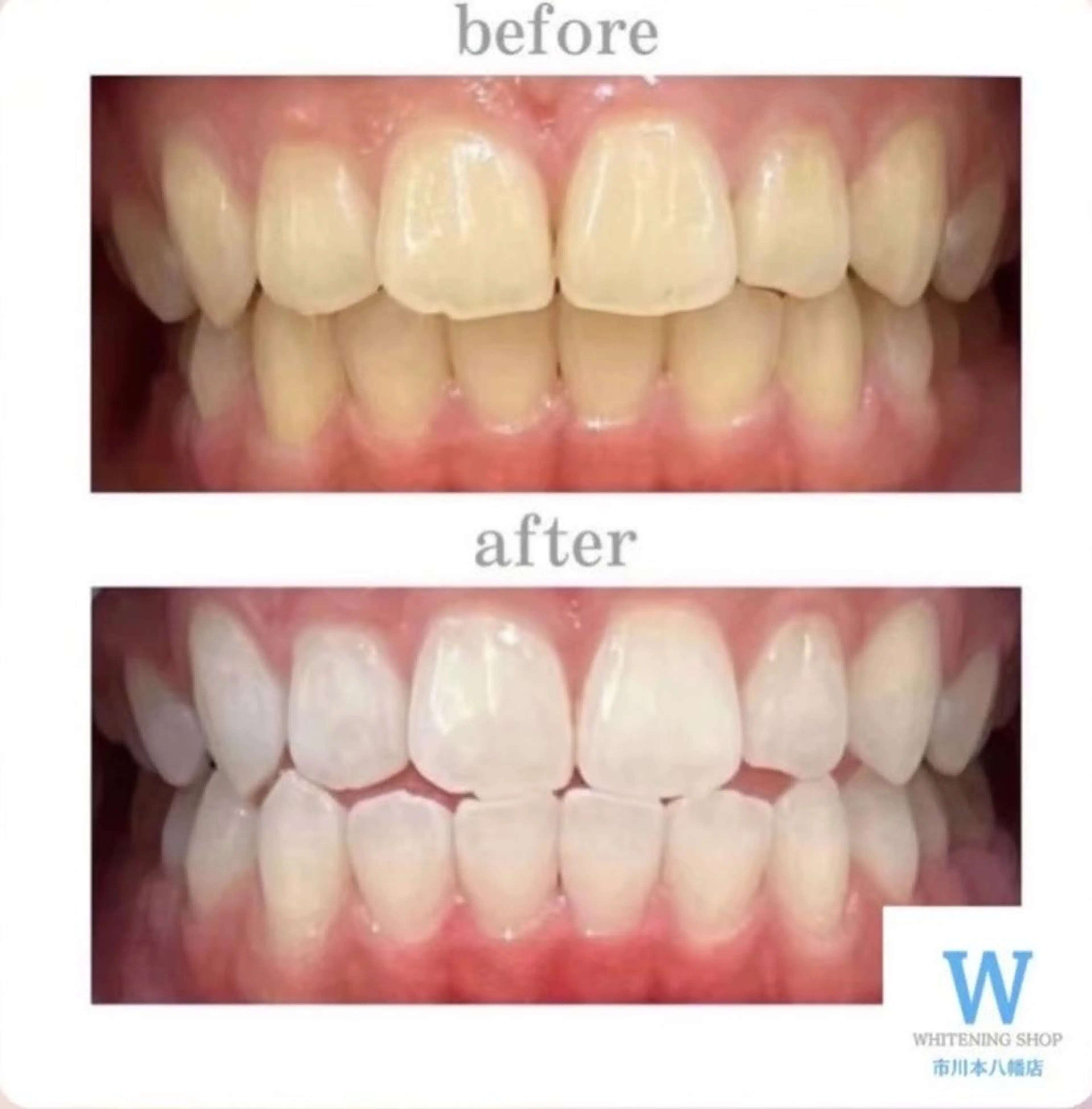 エステ リラク ホワイトニング ショップ本八幡店のエステ・リラクイメージ