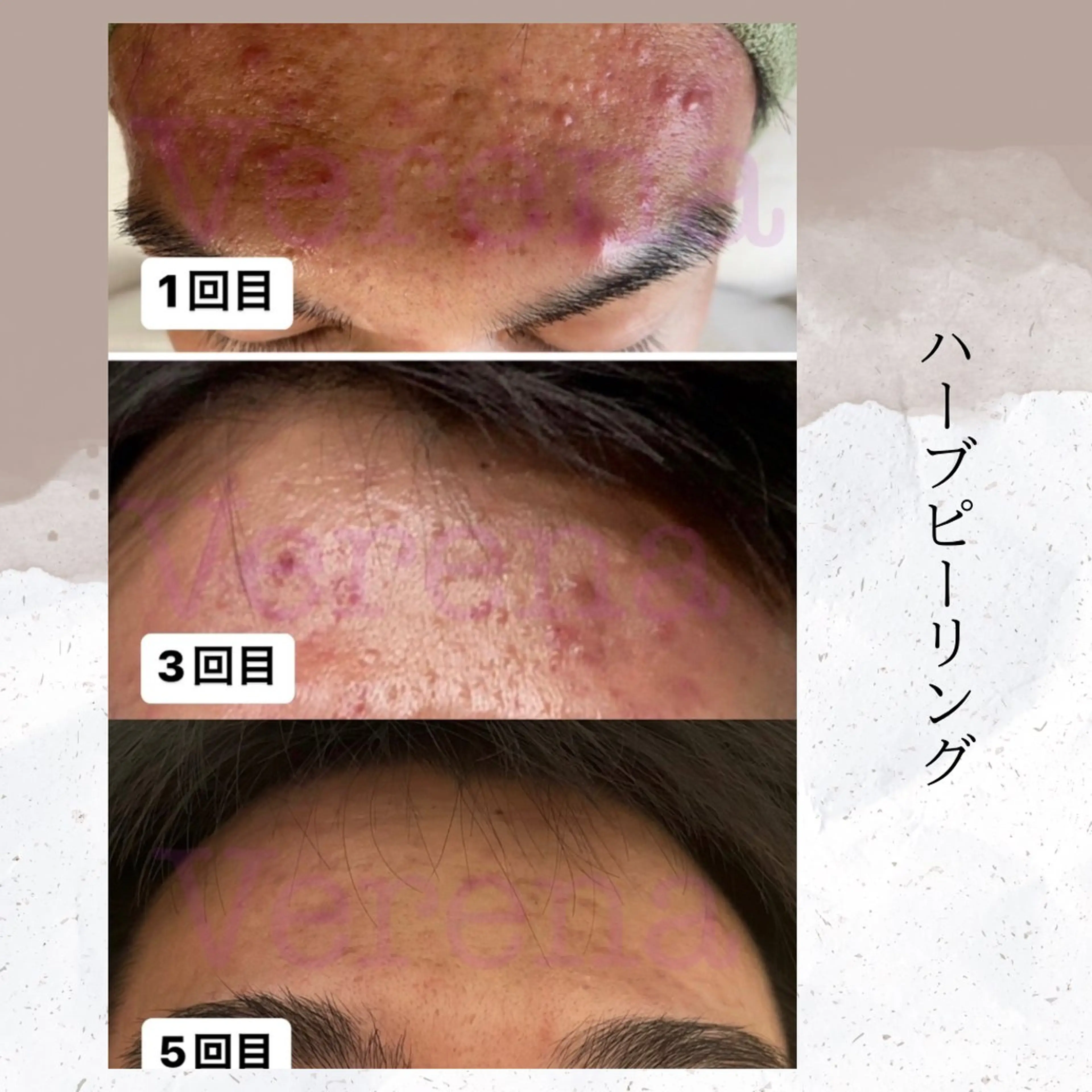 エステ リラク ピーリング専門店 Belluteのエステ・リラクイメージ