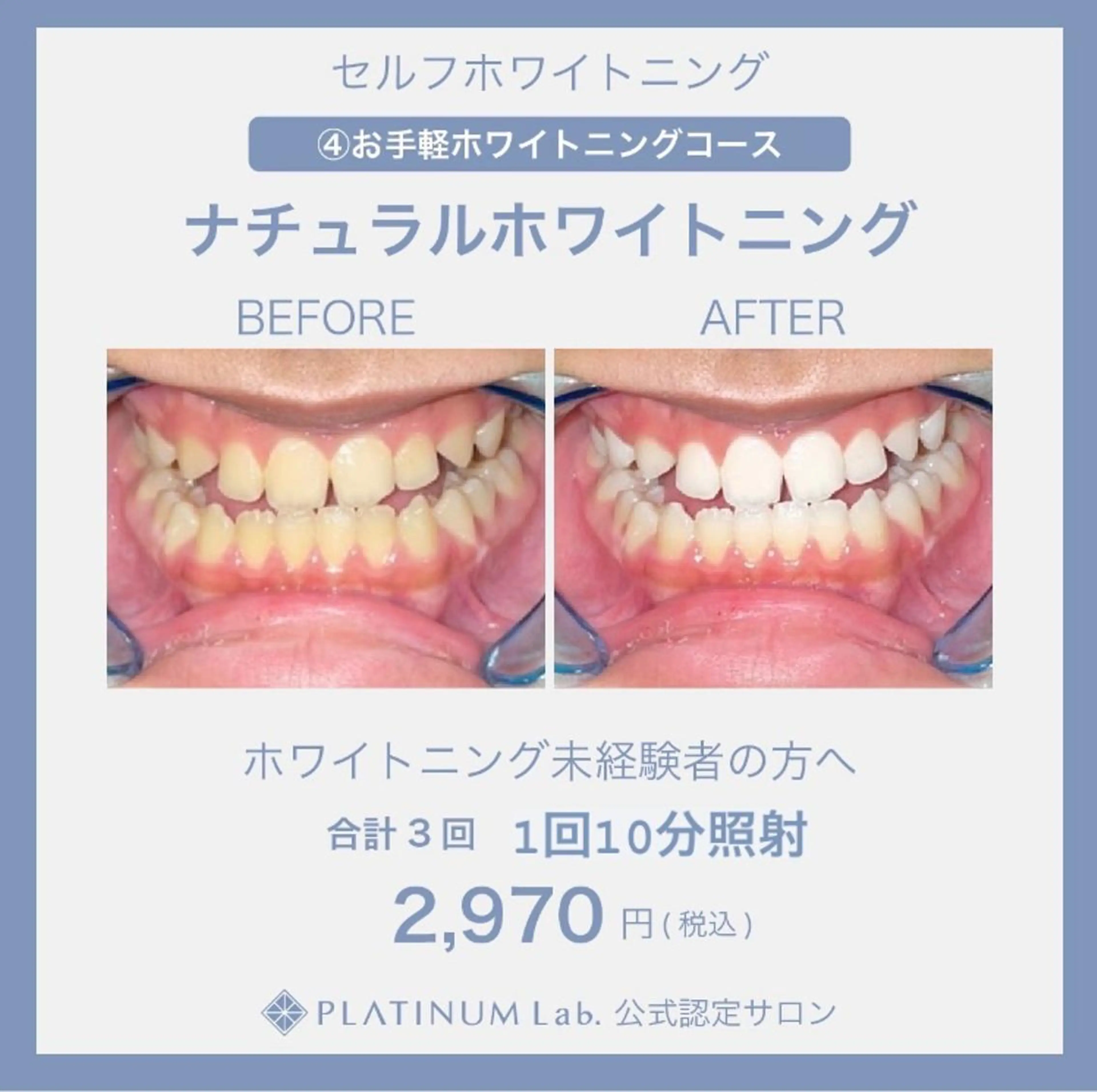 メンズ キッズ ネイル マツエク・マツパ アイブロウ プラチナムビューティー柏所属・【歯科提携】柏ホワイ トニング専門店のその他イメージ