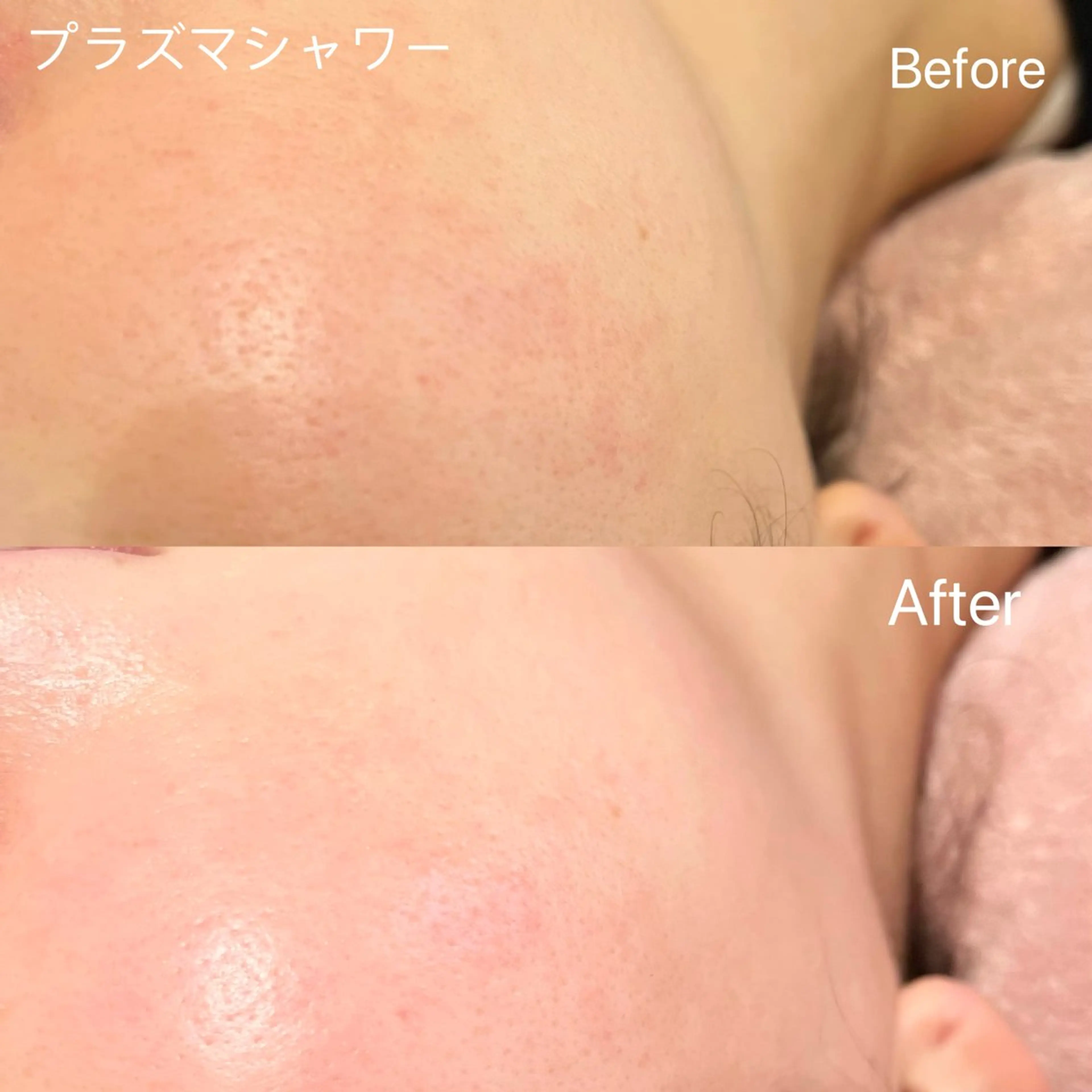 エステ アイラッシュ&エステサロンLinda西宮所属・小顔&肌質改善 LINDA西宮 AIのエステ・リラクイメージ