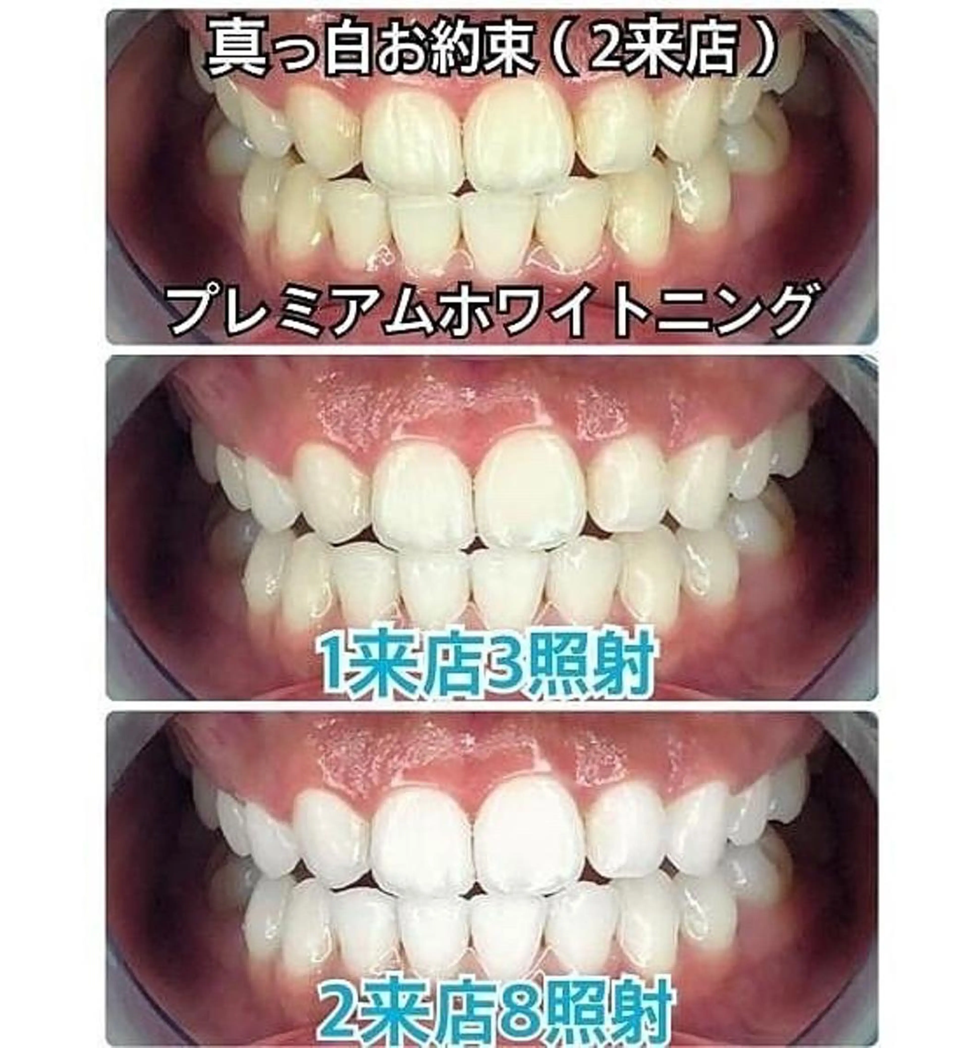 プラチナムビューティー柏所属・【歯科連携】柏ホワイ トニング専門店のその他イメージ