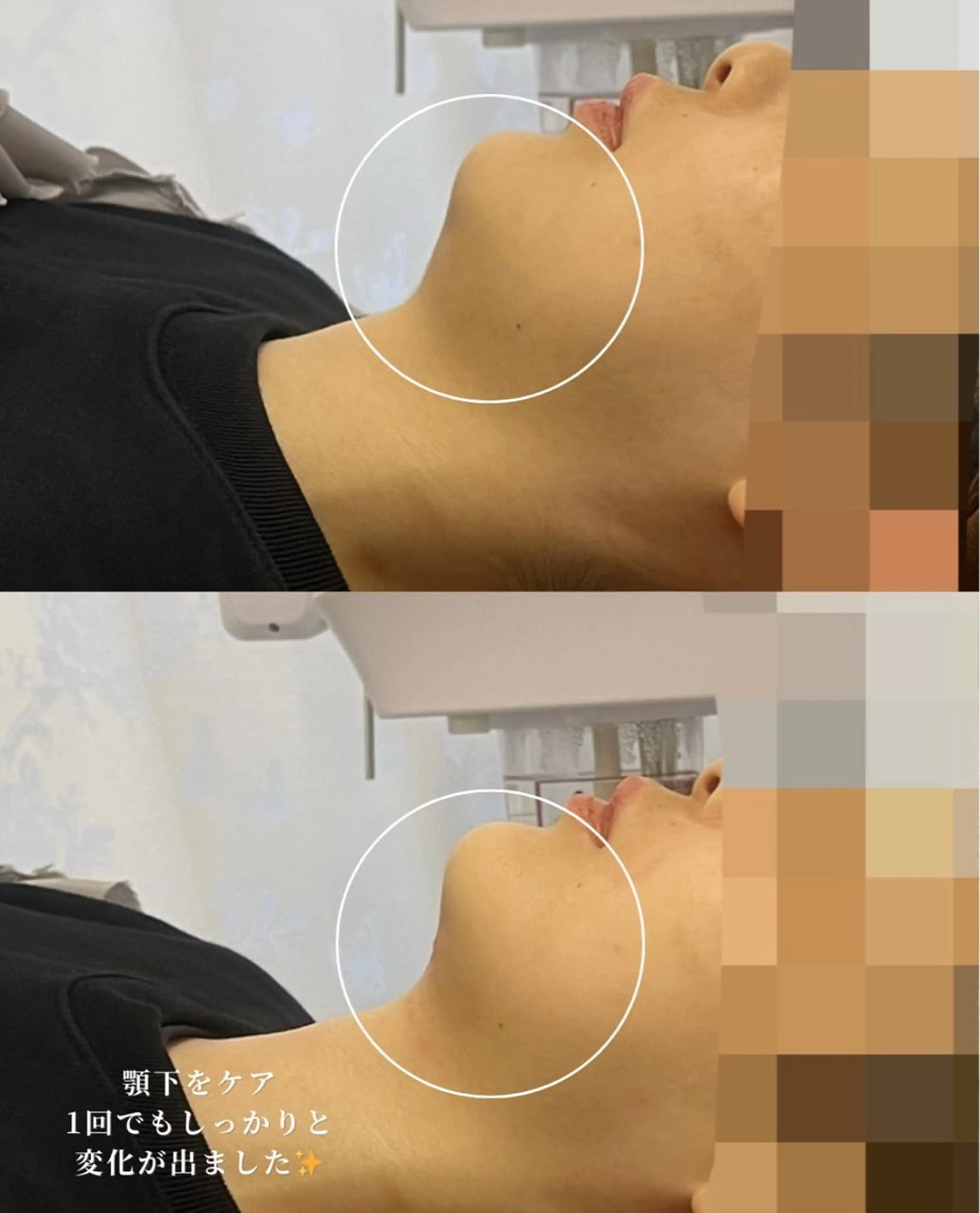 エステ 看護師が施術する ナスサロ/Emi🪽のエステ・リラクイメージ