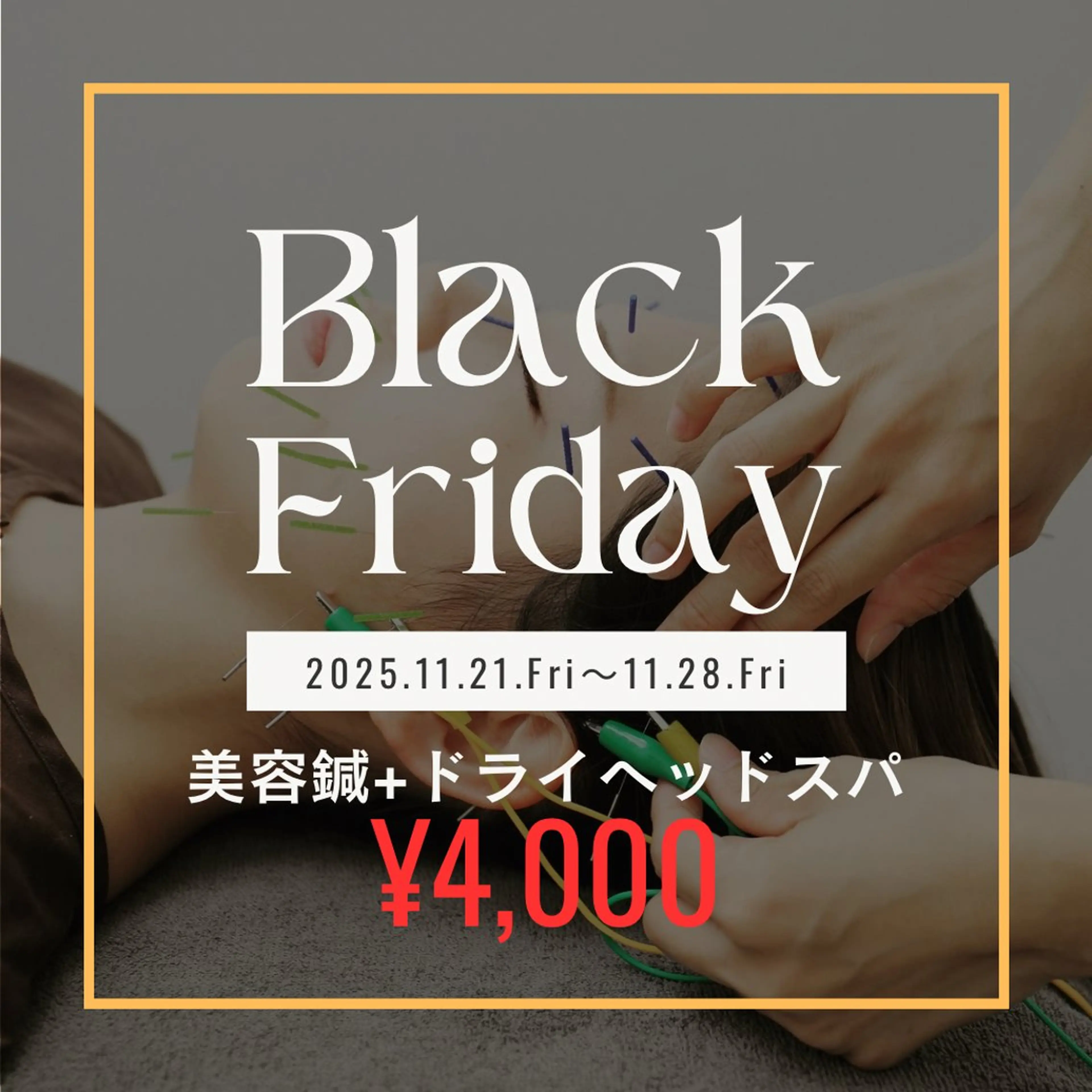 【🉐BLACK FRIDAY🉐】美容鍼(45分)※写真掲載OKの方限定※の写真