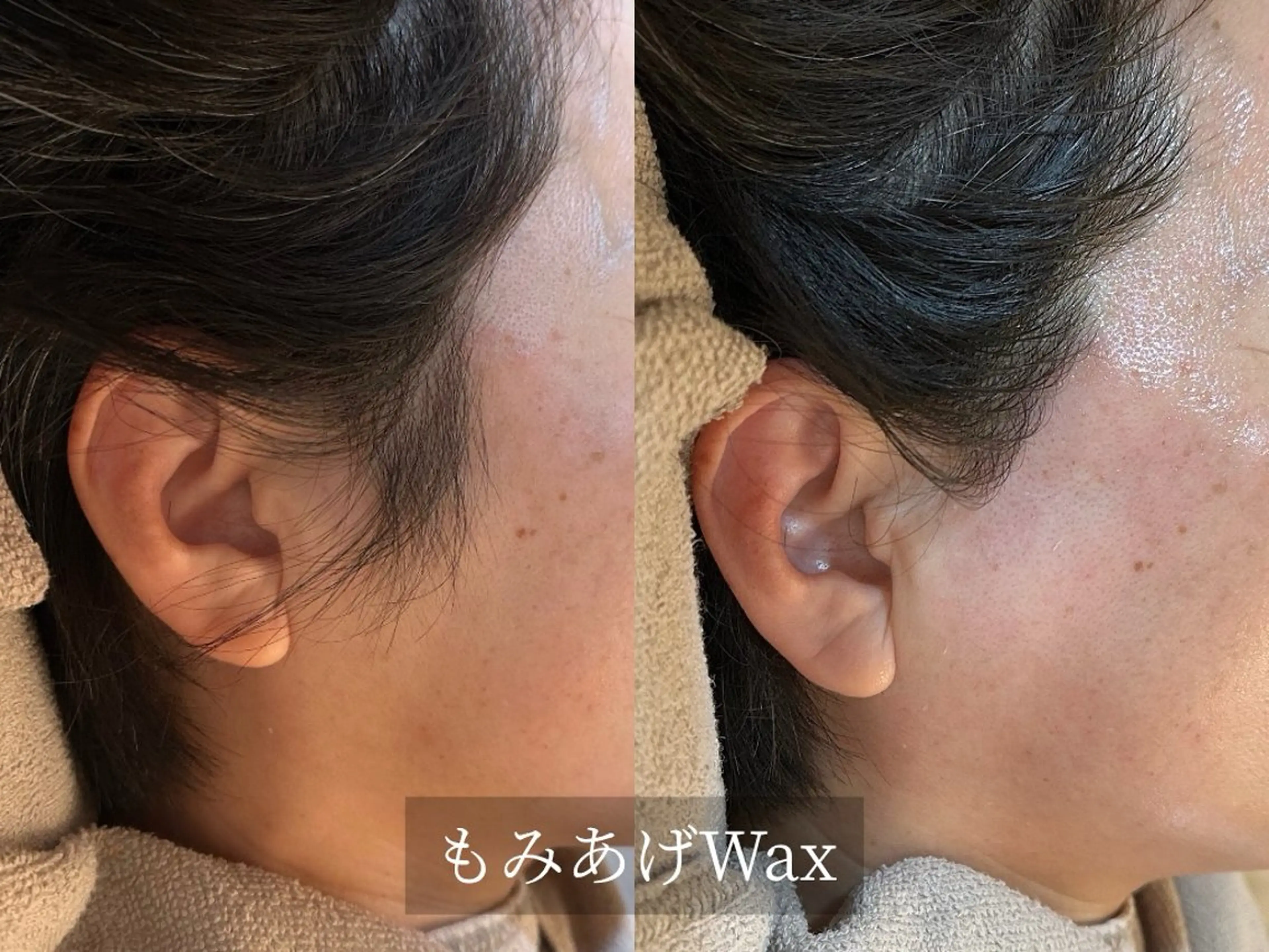 プライベート脱毛サロン　Arum所属・脱毛サロン Arumのエステ・リラクイメージ