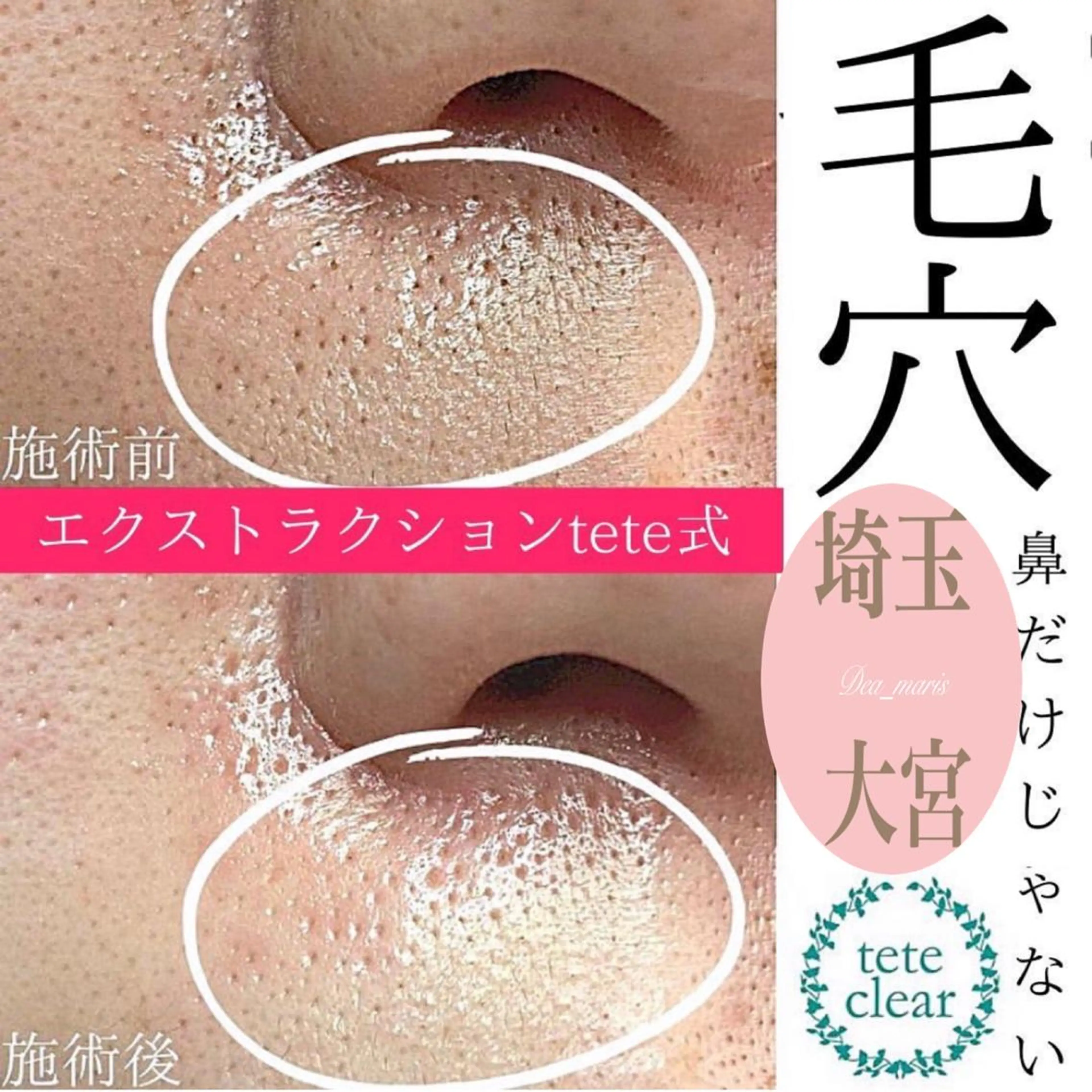 private salon  Dea_maris シュガーリング＆パーソナルボディケア所属・グランプリ受賞👑肌 体も別人級に変えるのエステ・リラクイメージ