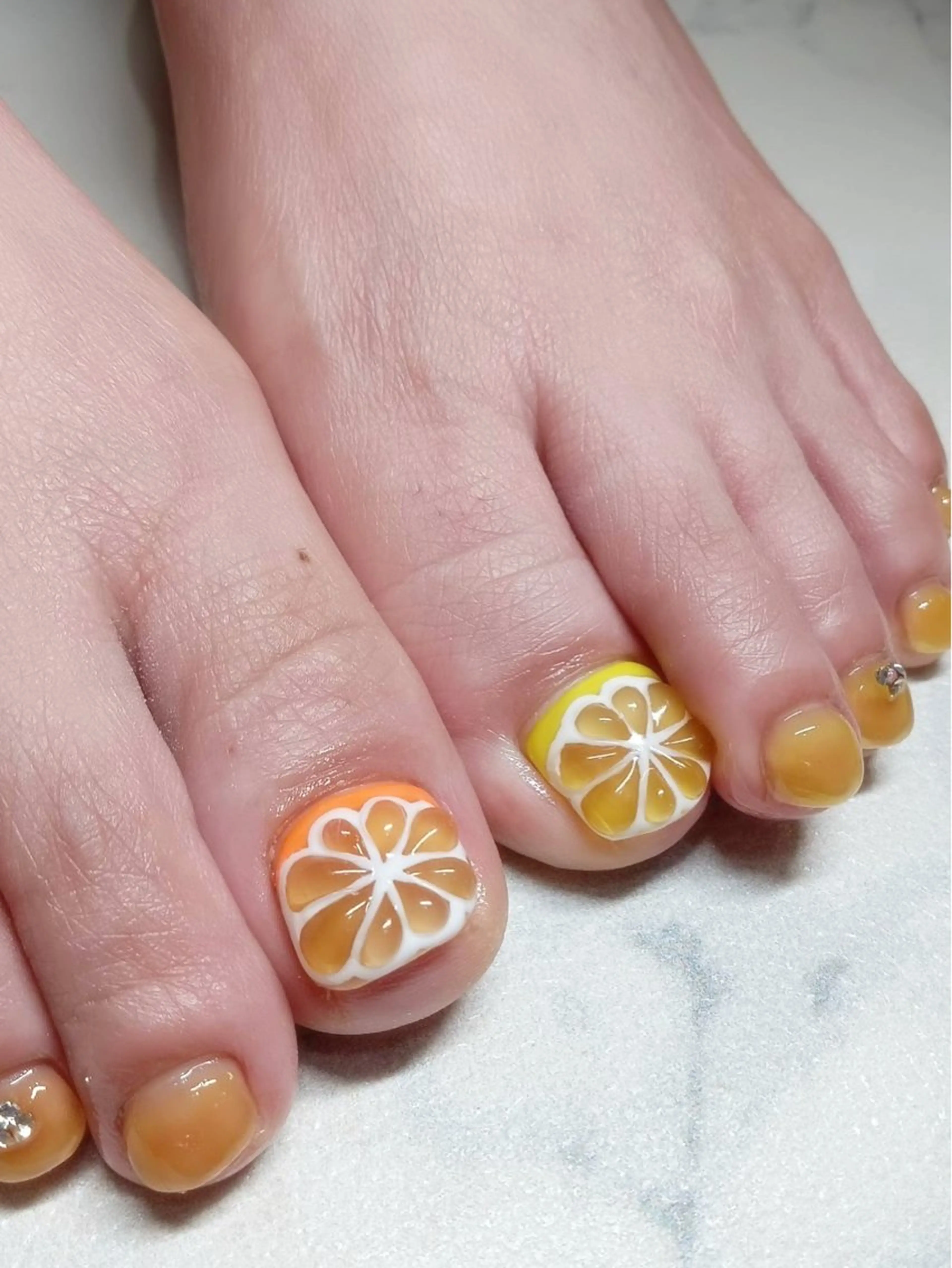 フット2本持ち込みの写真