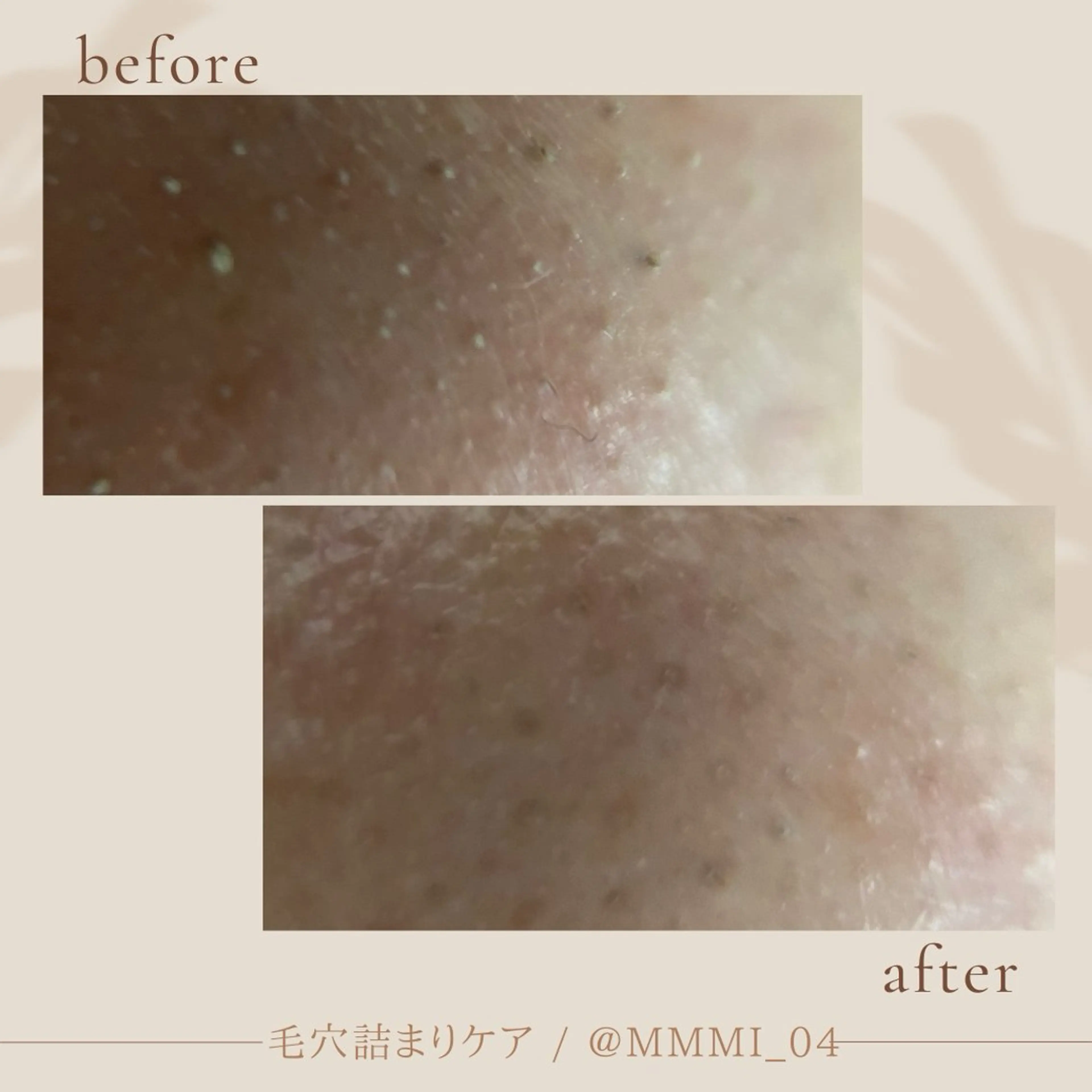 デ・アイム新潟北所属・サイトウ .のエステ・リラクイメージ