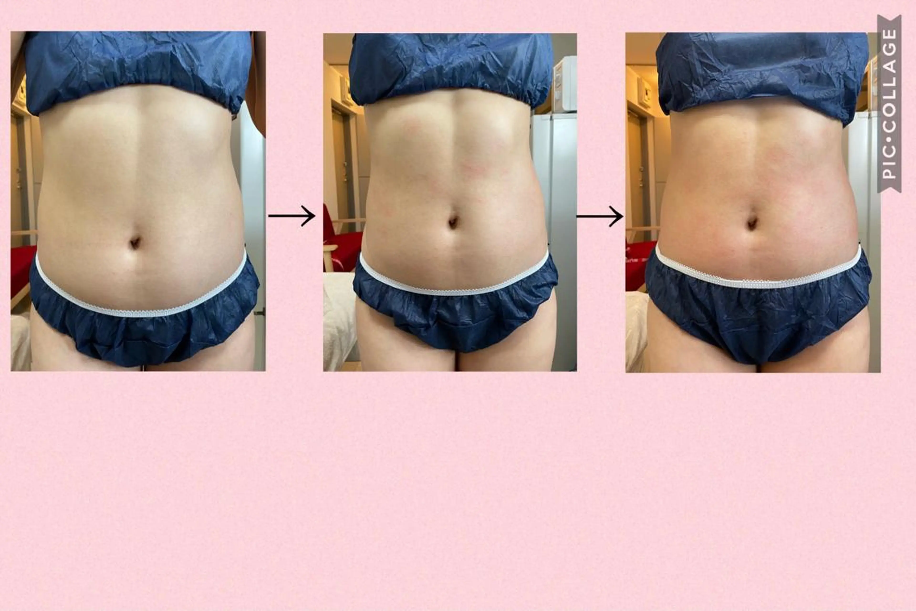 まつ毛パーマ・美肌 ナチュラル　ボーテのマツエク・マツパデザイン