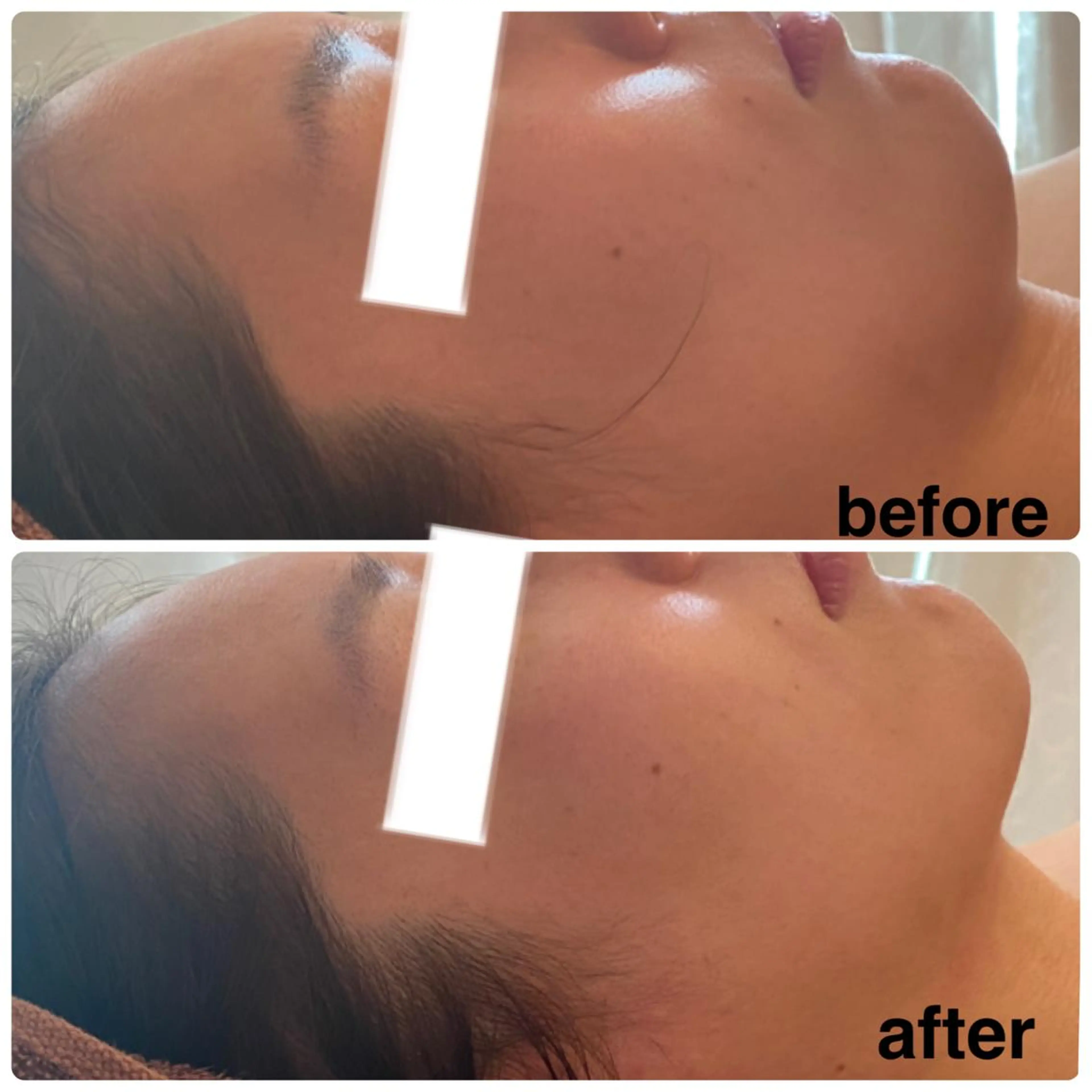 FLEUR大阪・整体 ・ハイフ・痩身・小顔のエステ・リラクイメージ