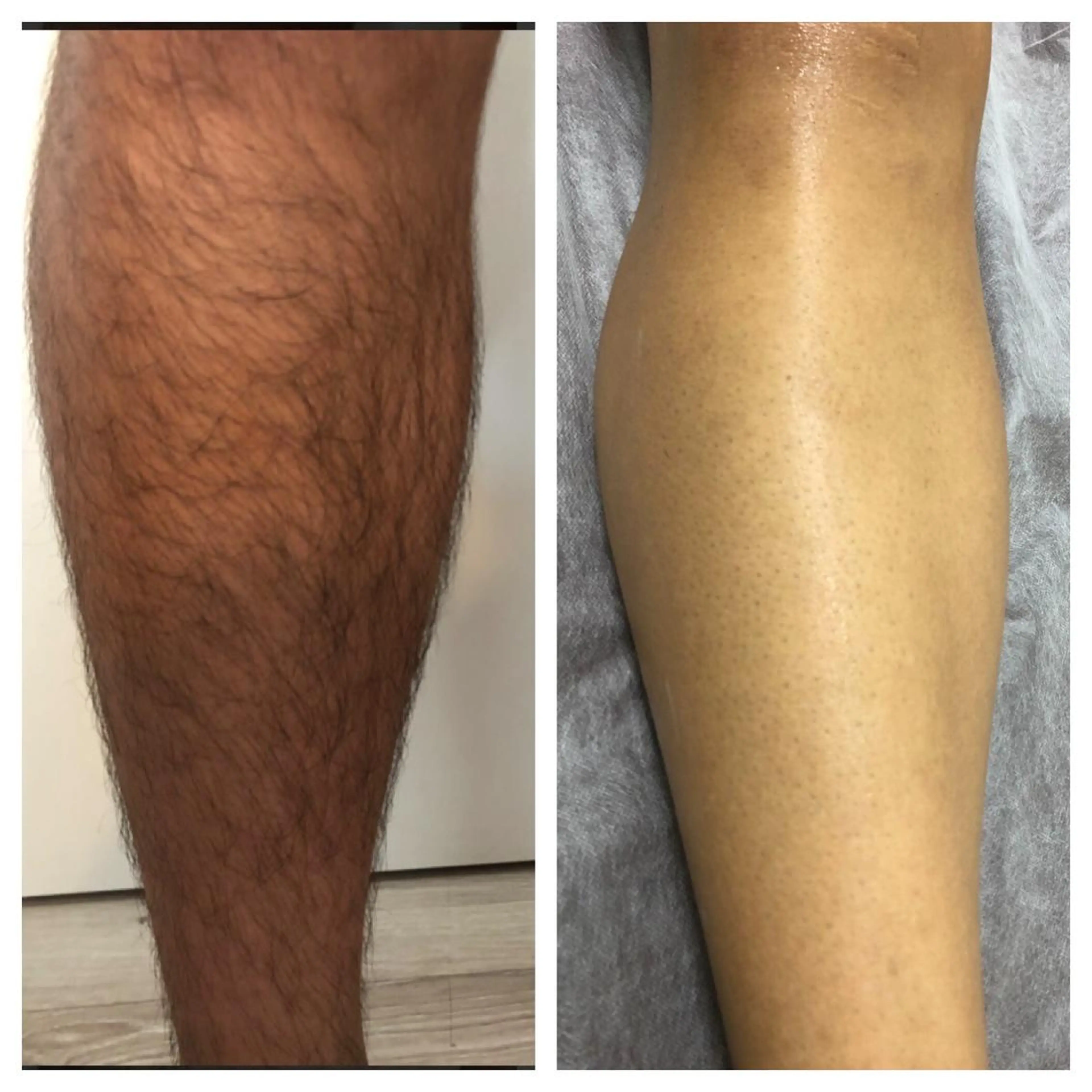 メンズ たにがわ整骨院　　salon  de  epila所属・salon   de epilaのエステ・リラクイメージ