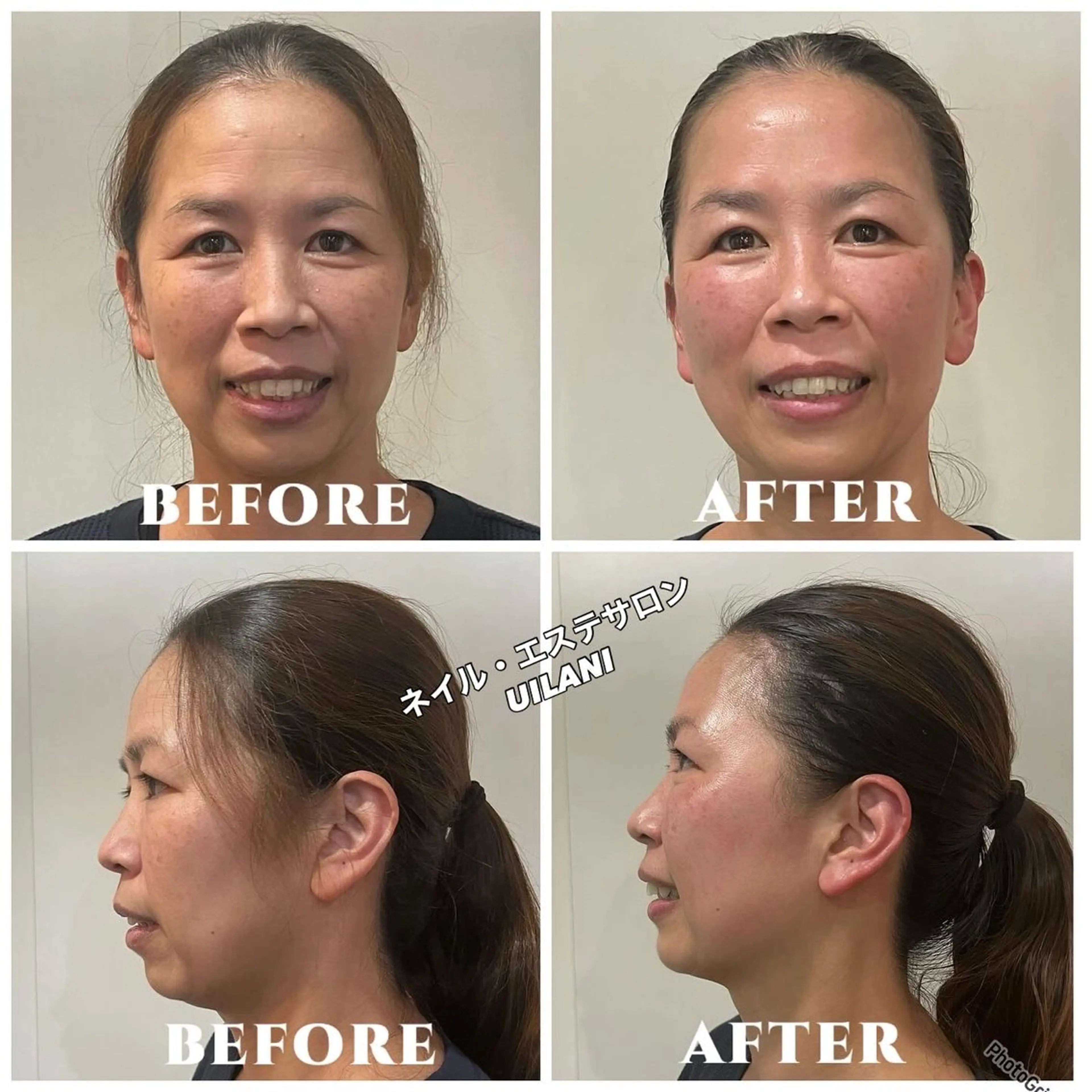 エステ リラク ネイル・エステサロンUILANI所属・ネイル・エステサロン UILANIのネイルデザイン