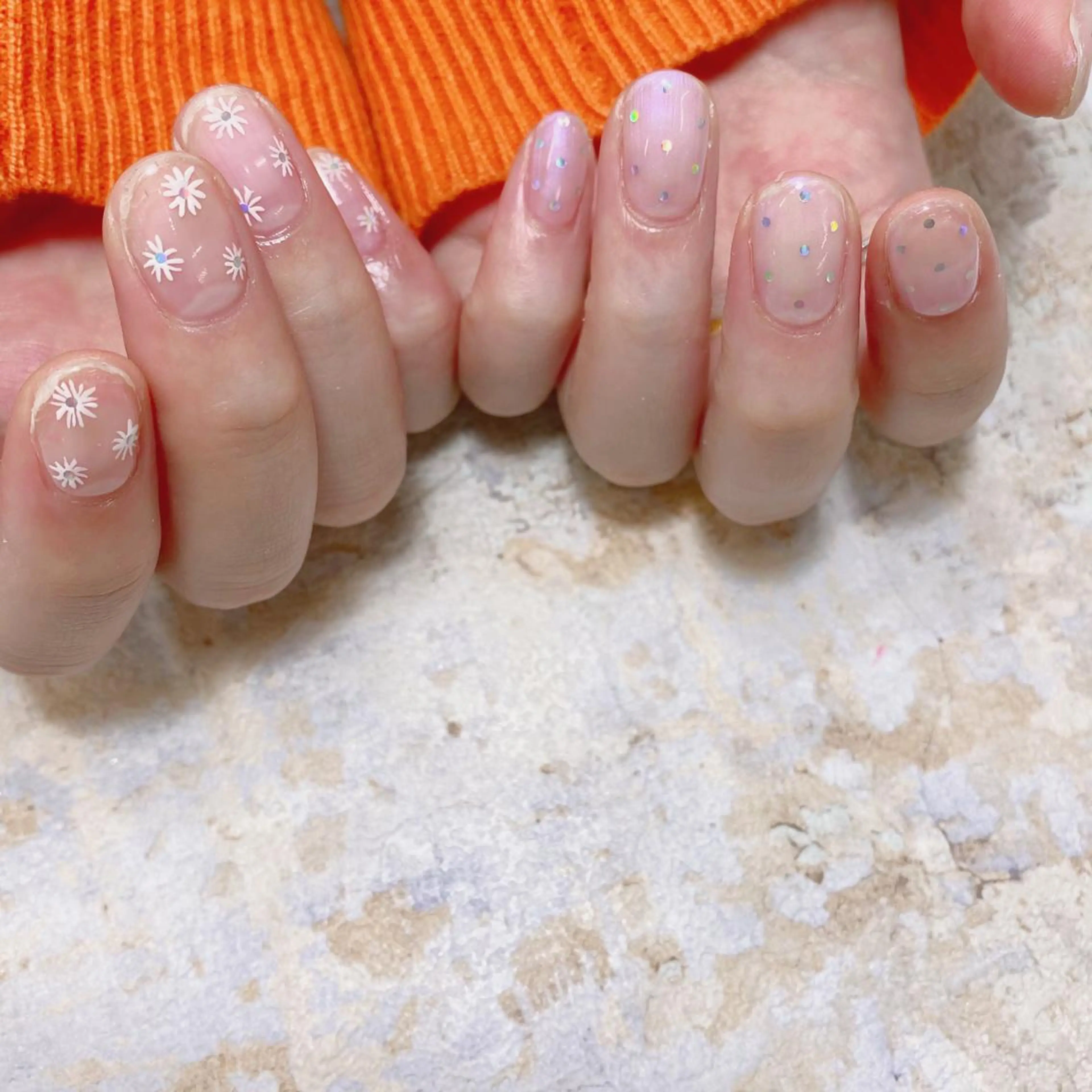 ネイル 巻き爪補正 Umber　Miyaのネイルデザイン