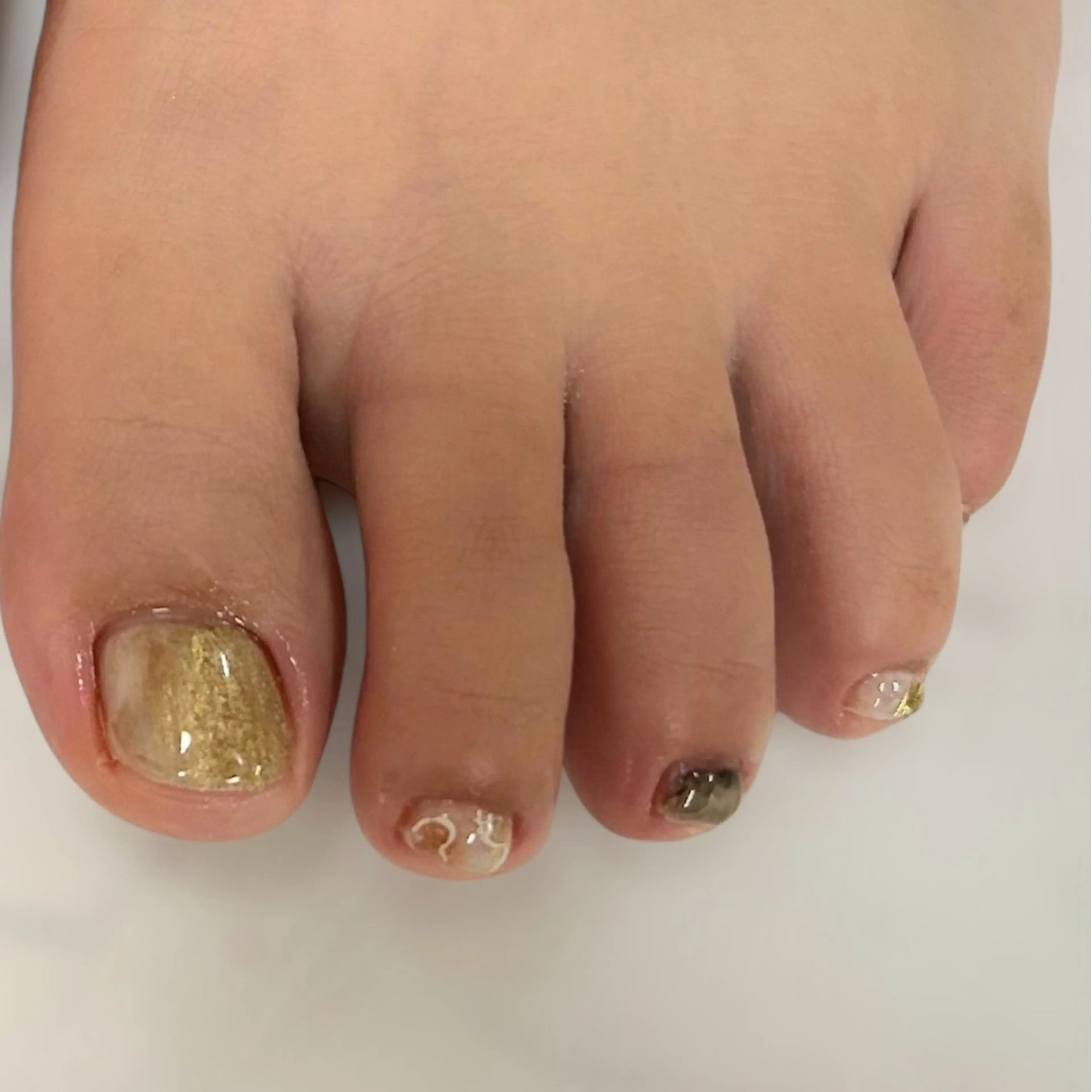 ネイル フットネイル アトリエ　ミモザ所属・いまむら あかりのネイルデザイン