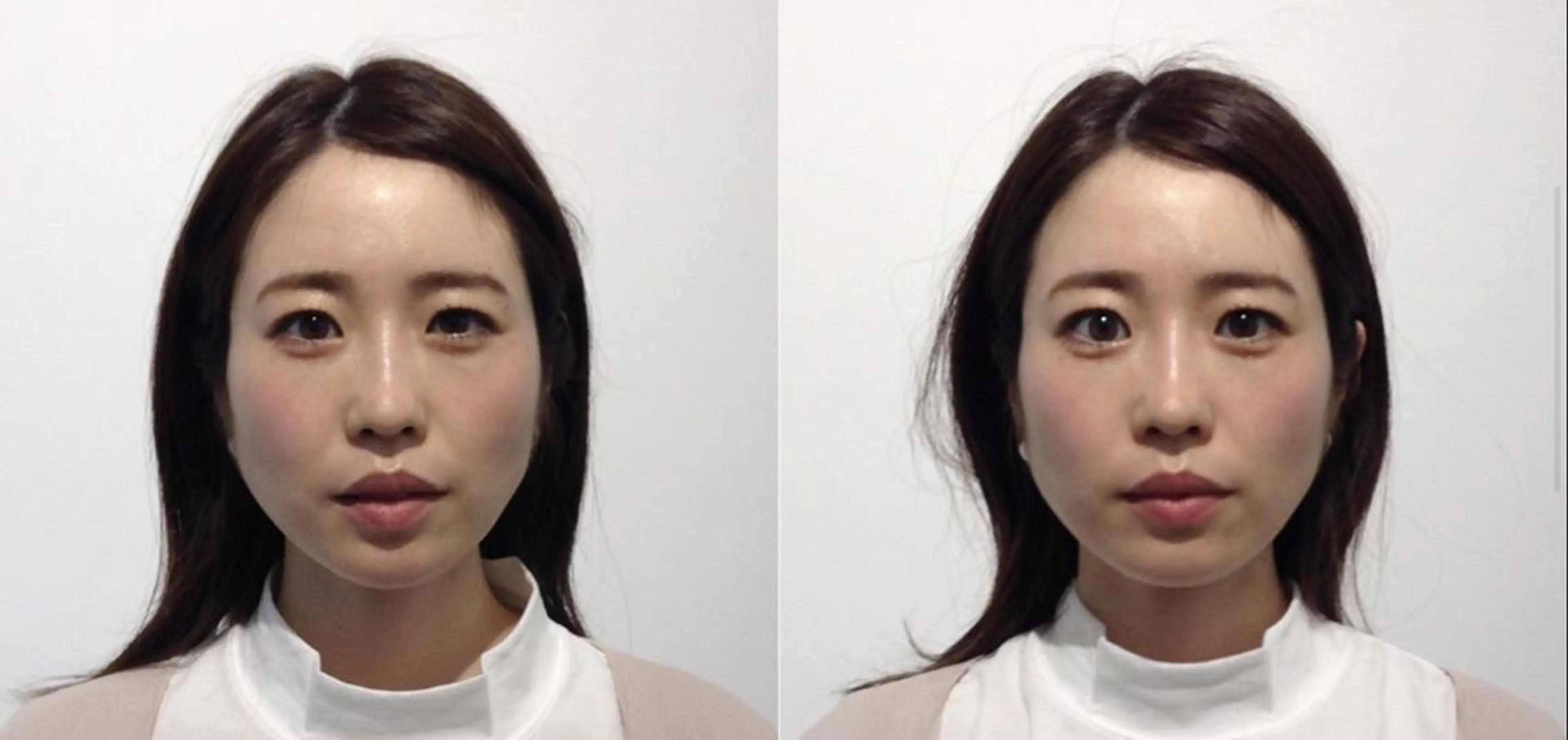 美容整体　小顔矯正 プラスフィール 松本のエステ・リラクイメージ