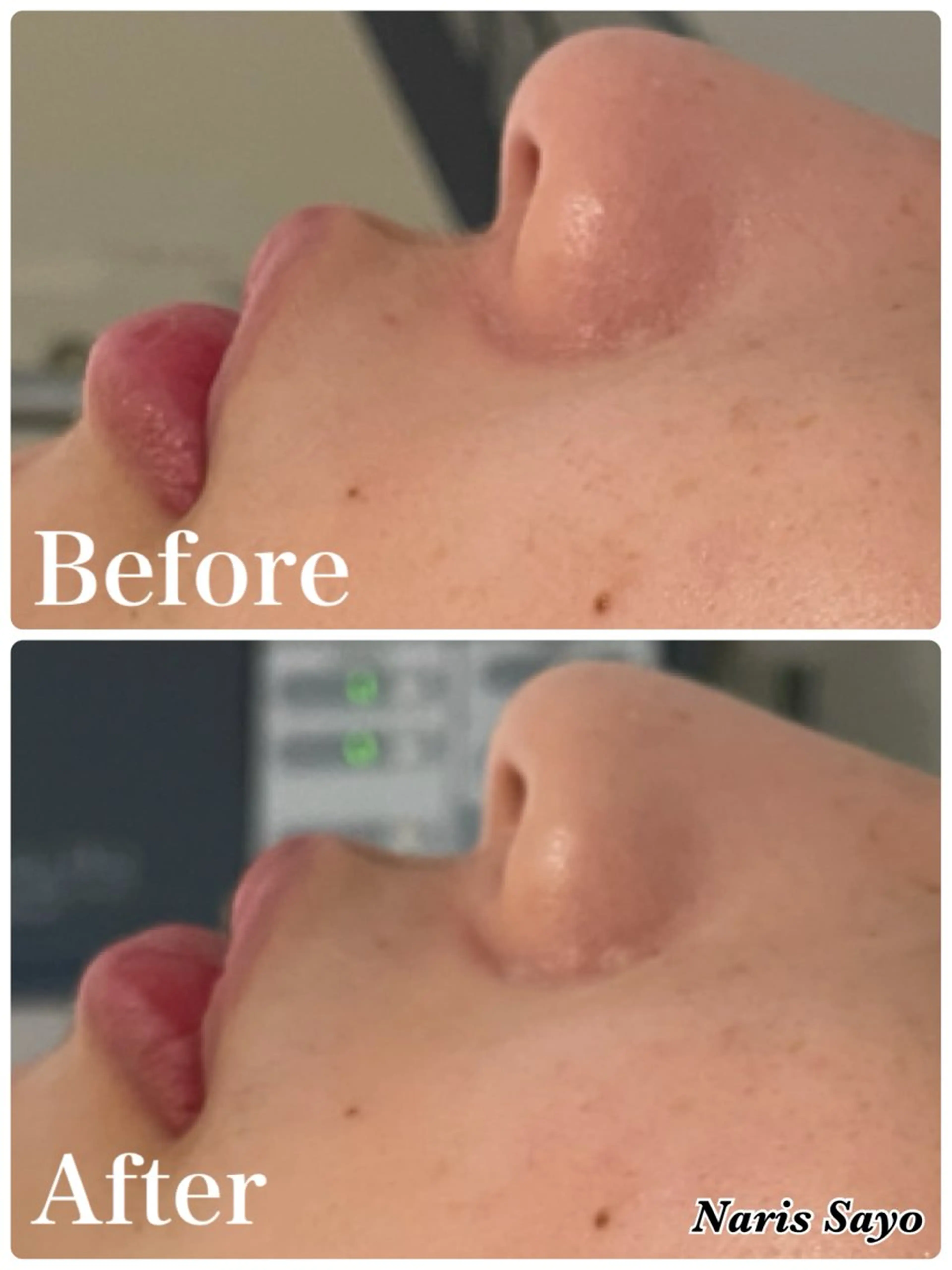 デ・アイム豊中所属・朝山 紗世子のエステ・リラクイメージ