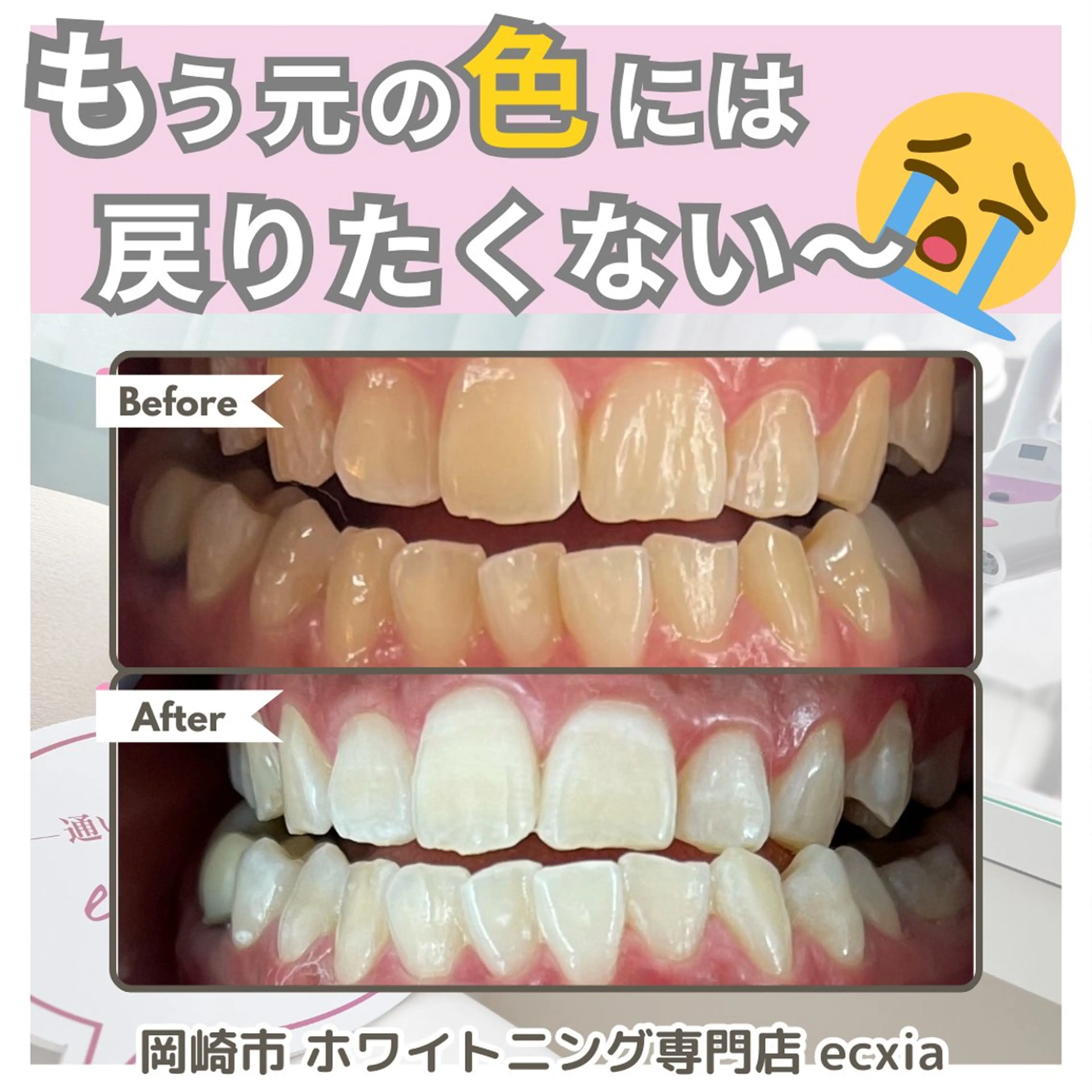 セルフホワイトニング エクシア岡崎店所属・ホワイトニング/脱毛 専門店エクシア岡崎店のその他イメージ