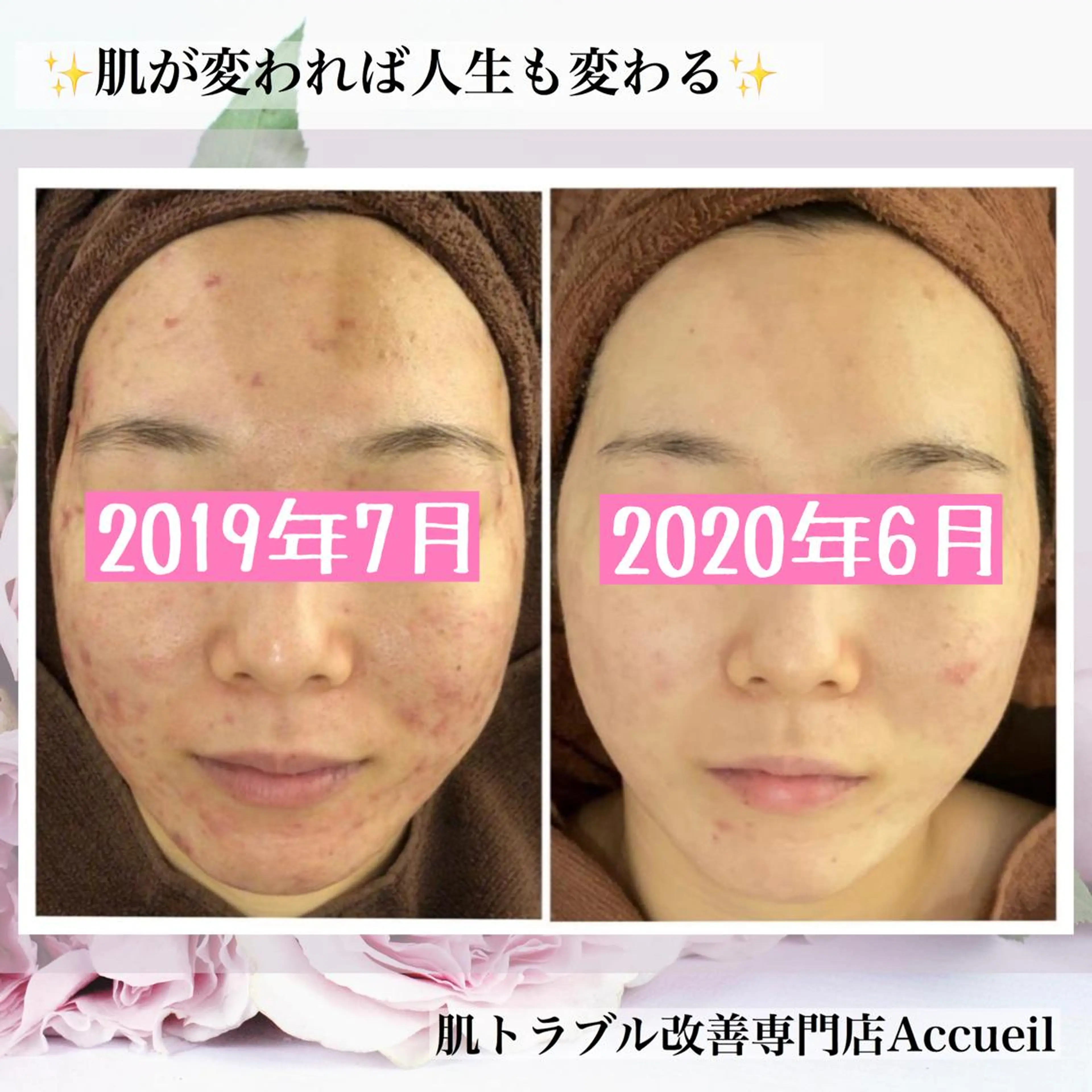 ミディアム カラー パーマ ヘアアレンジ メンズ キッズ ネイル マツエク・マツパ アイブロウ エステ リラク アクール　齋藤 ♡肌トラブル卒業のエステ・リラクイメージ