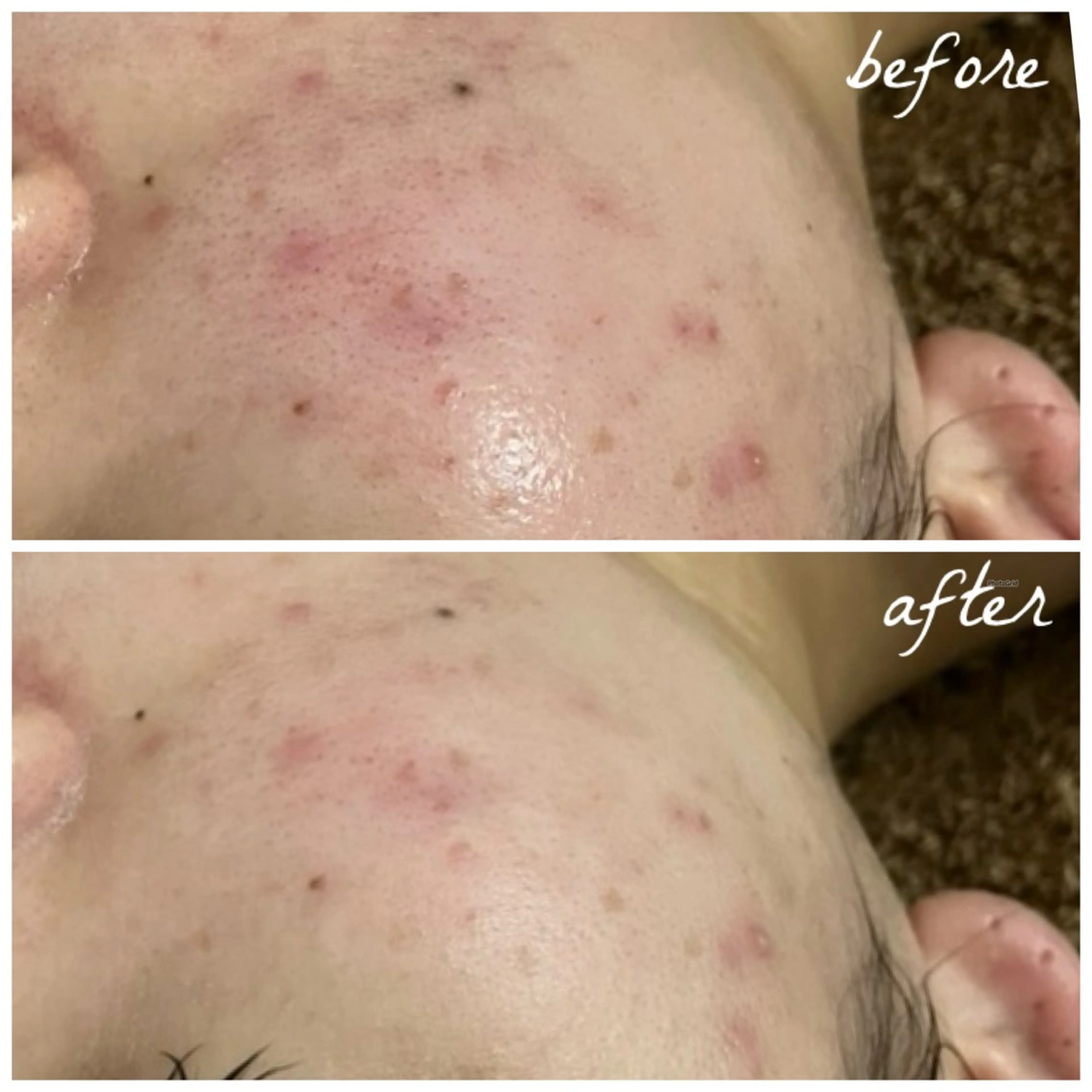 メンズ エステ メナード岐阜茜部 杉浦のエステ・リラクイメージ