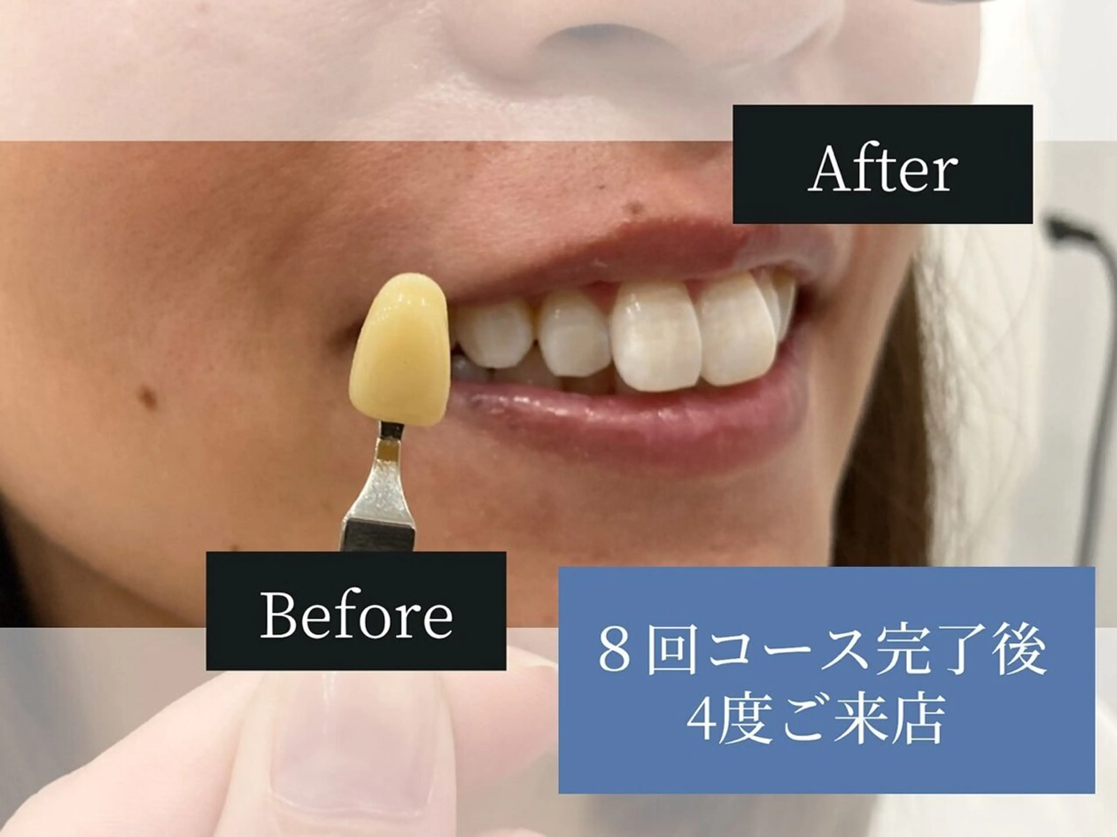 ホワイトニングカフェ中野店所属・ホワイトニングカフェ 中野店のその他イメージ