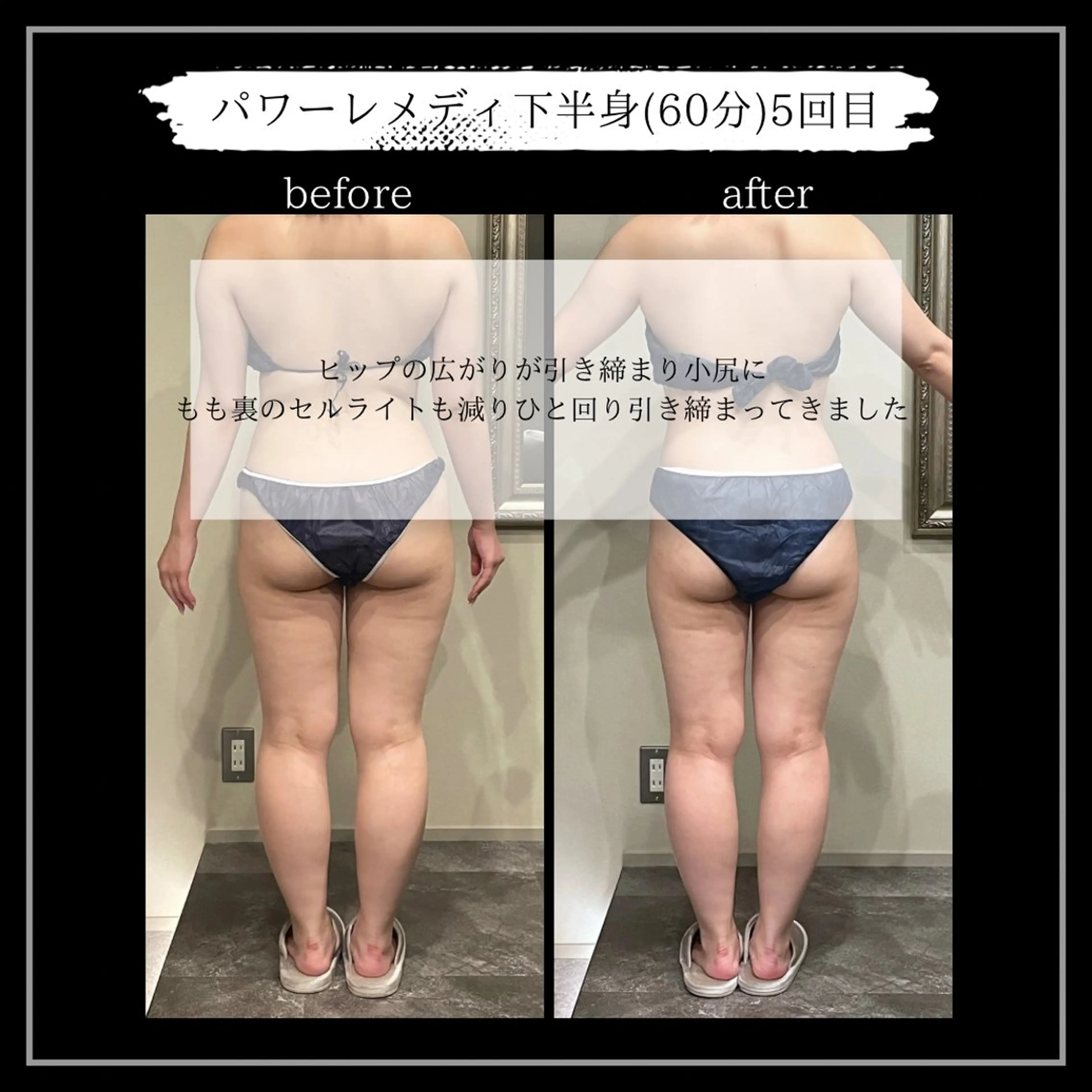 オフ:オン所属・オフ:オン 全身筋膜マッサージのエステ・リラクイメージ