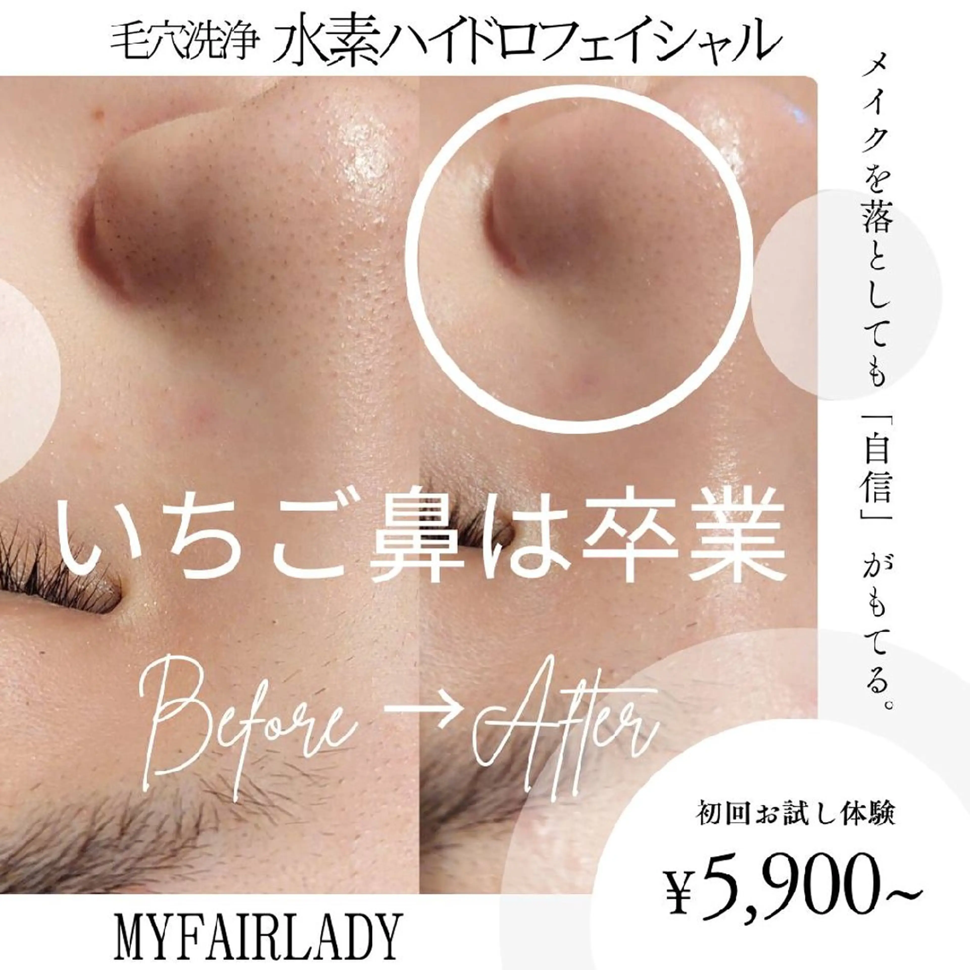 美肌小顔/脱毛/痩身 MyFairLadyのエステ・リラクイメージ