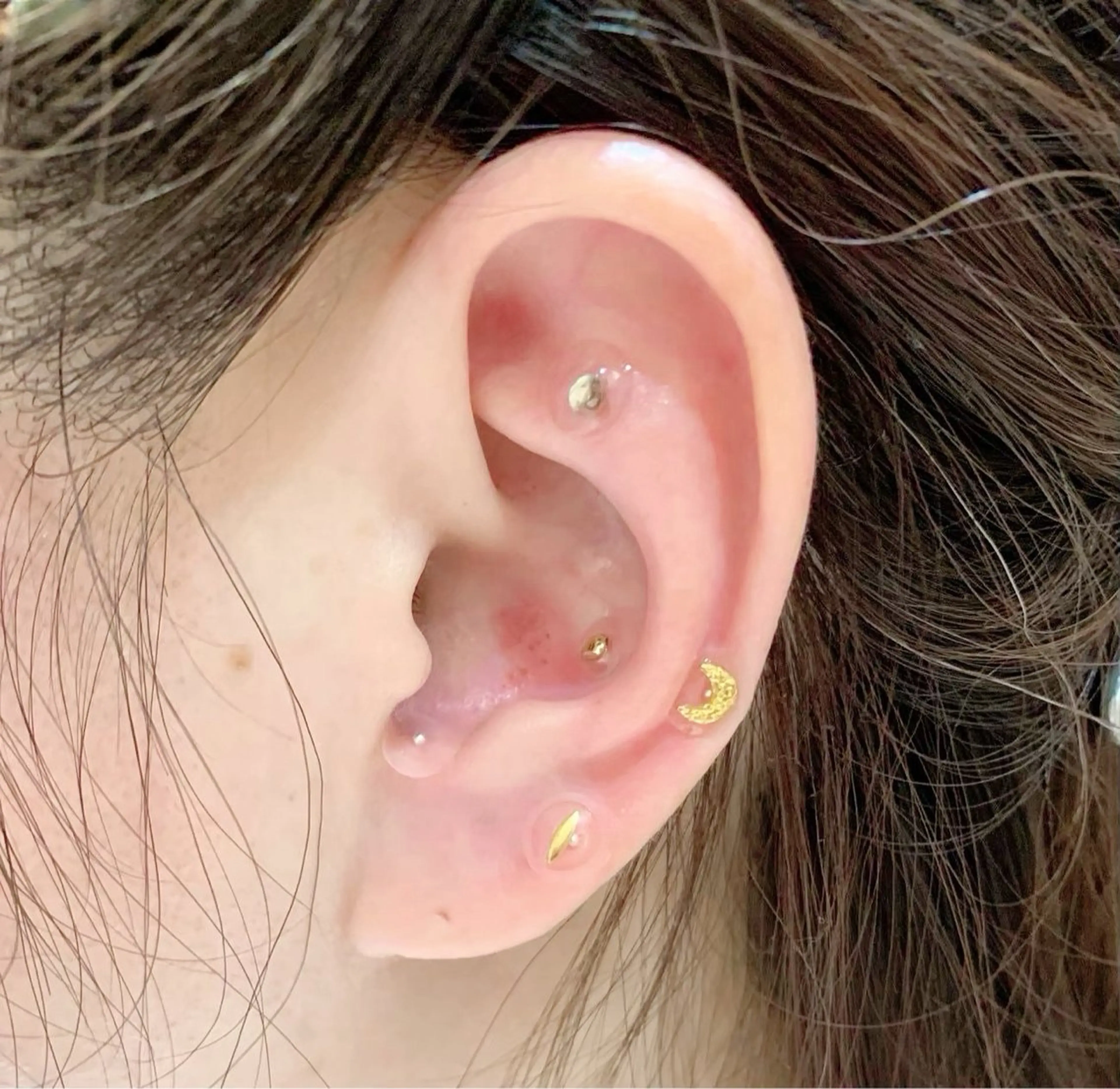 エステ リラク 痛くないシミ取り 【荻窪】石橋のヘアスタイル