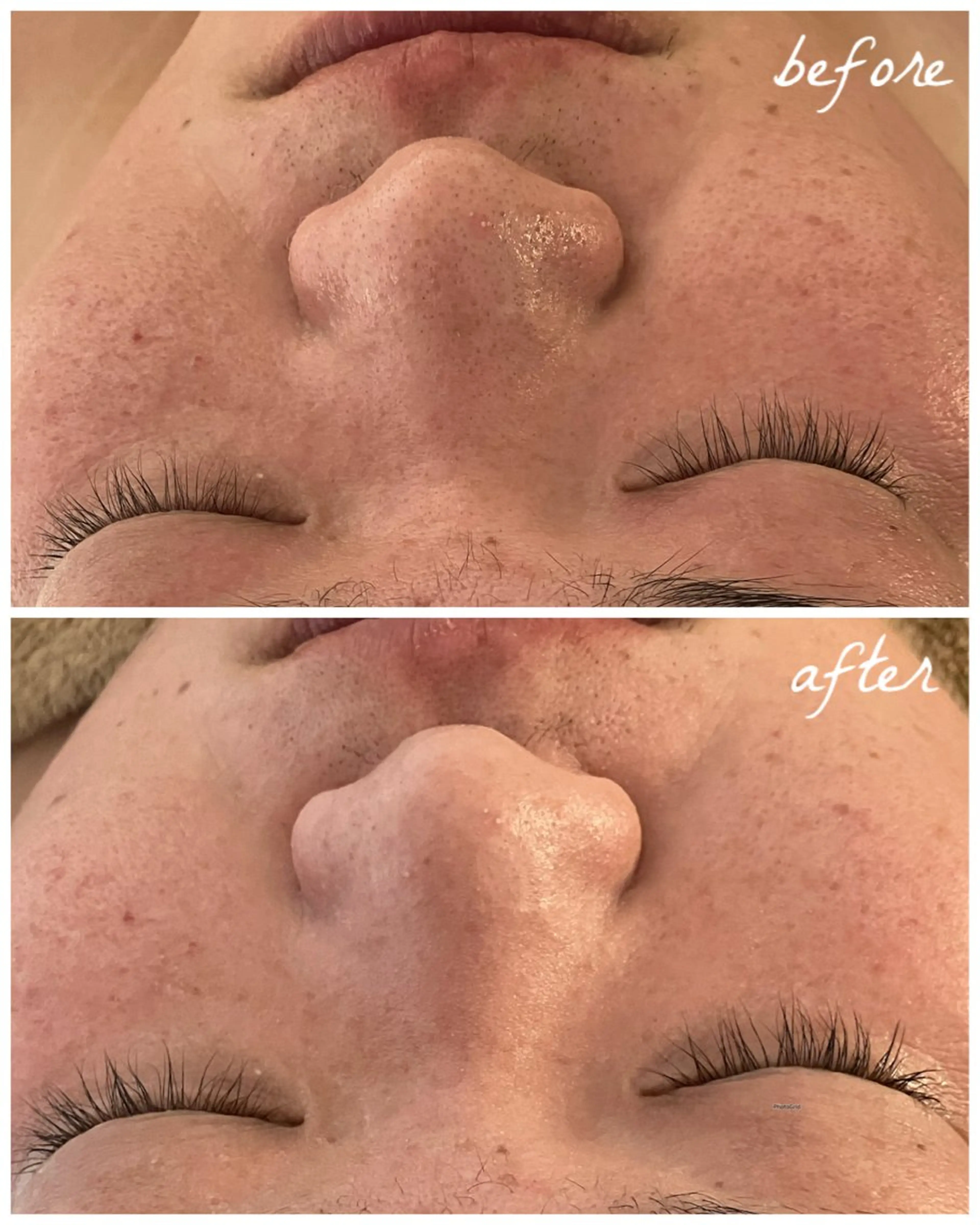 メンズ エステ メナード岐阜茜部 杉浦のエステ・リラクイメージ