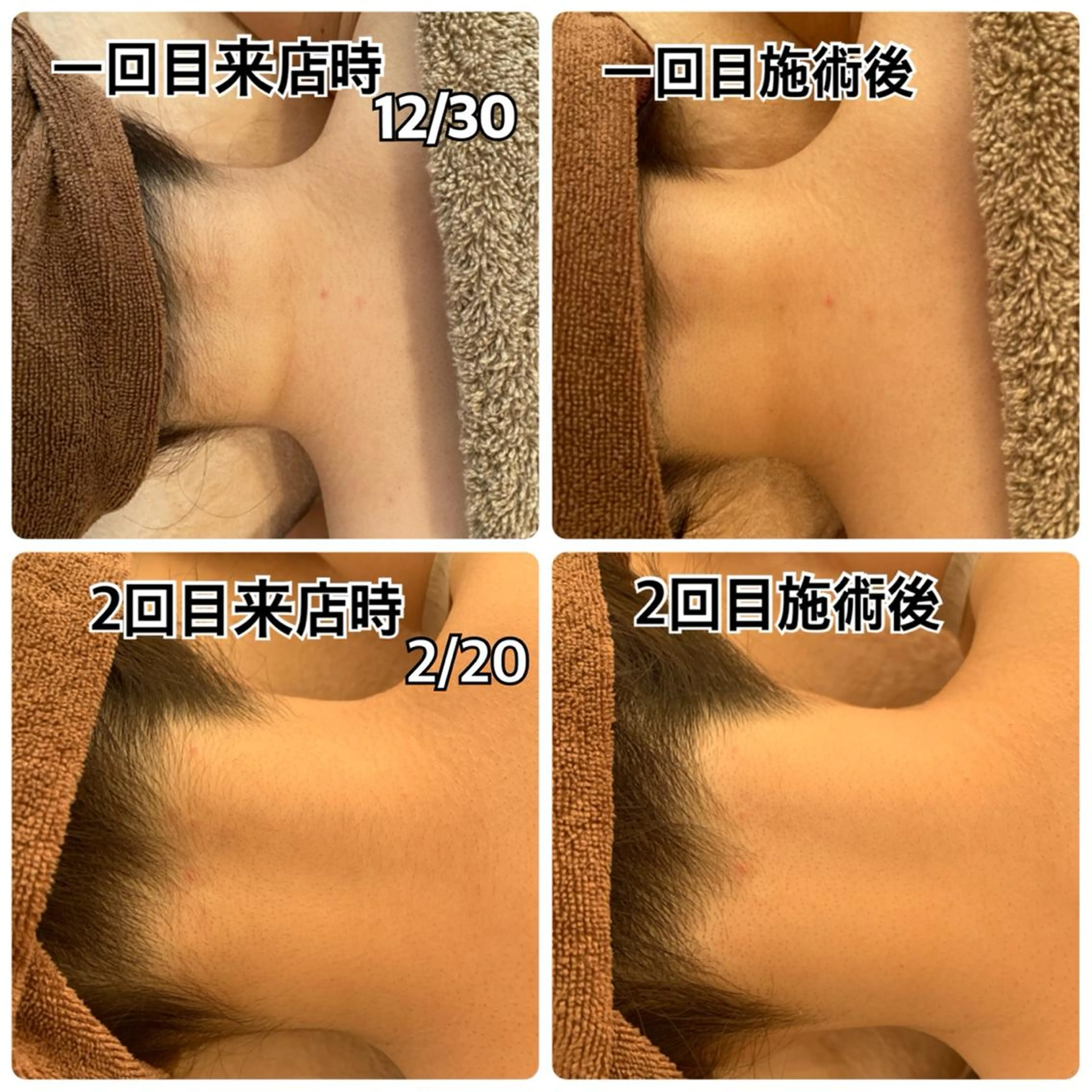美肌コラーゲン脱毛SINCERITE【サンセリテ】所属・瀬野 のぞみのエステ・リラクイメージ