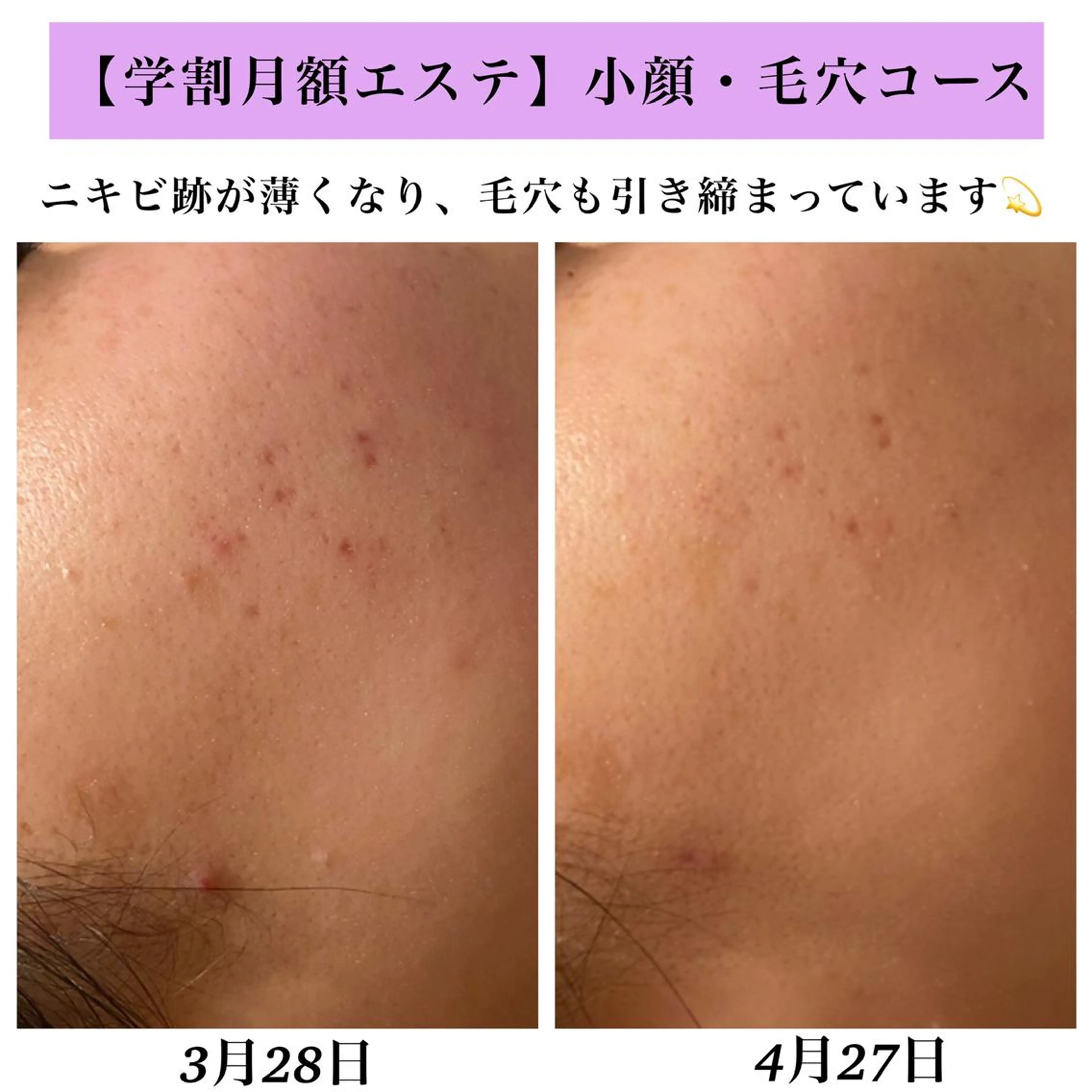 Bellesthe (ベルエステ)のエステ・リラクイメージ