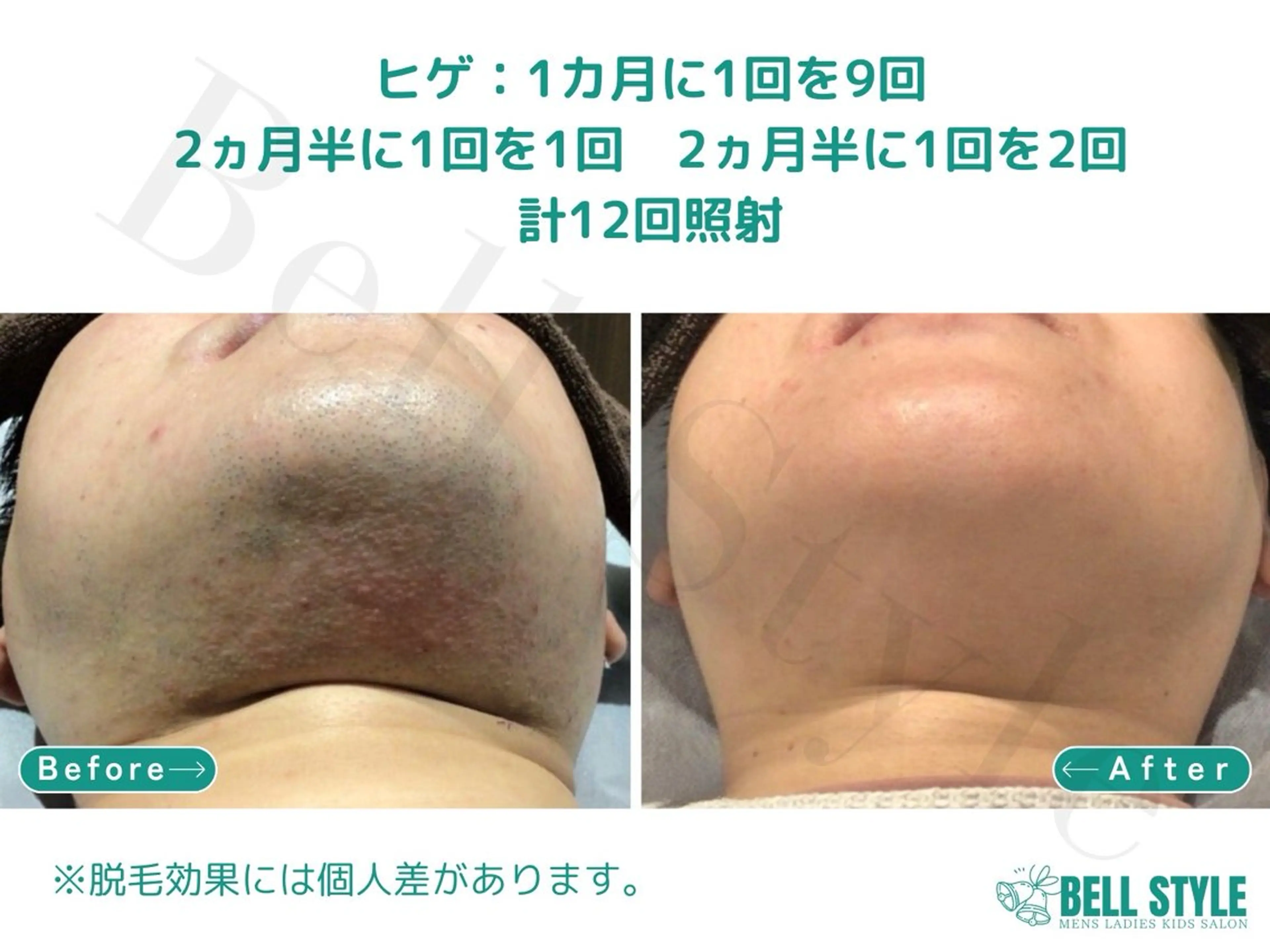 メンズ メンズ&レディース　Bell style所属・【脱毛・美肌専門】 bellstyleのエステ・リラクイメージ