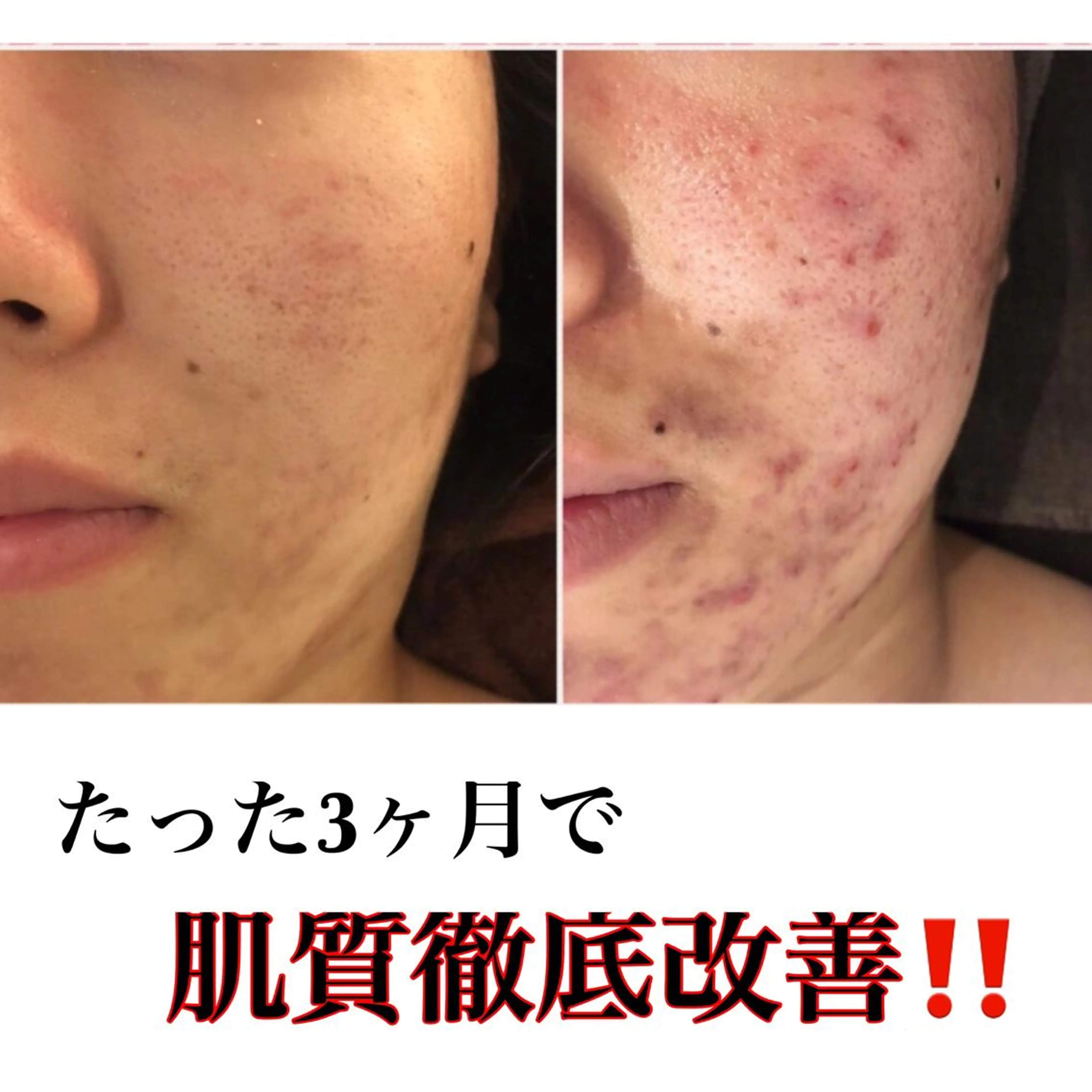 ミディアム カラー パーマ ヘアアレンジ メンズ キッズ ネイル マツエク・マツパ アクール　齋藤 ♡肌トラブル卒業のエステ・リラクイメージ
