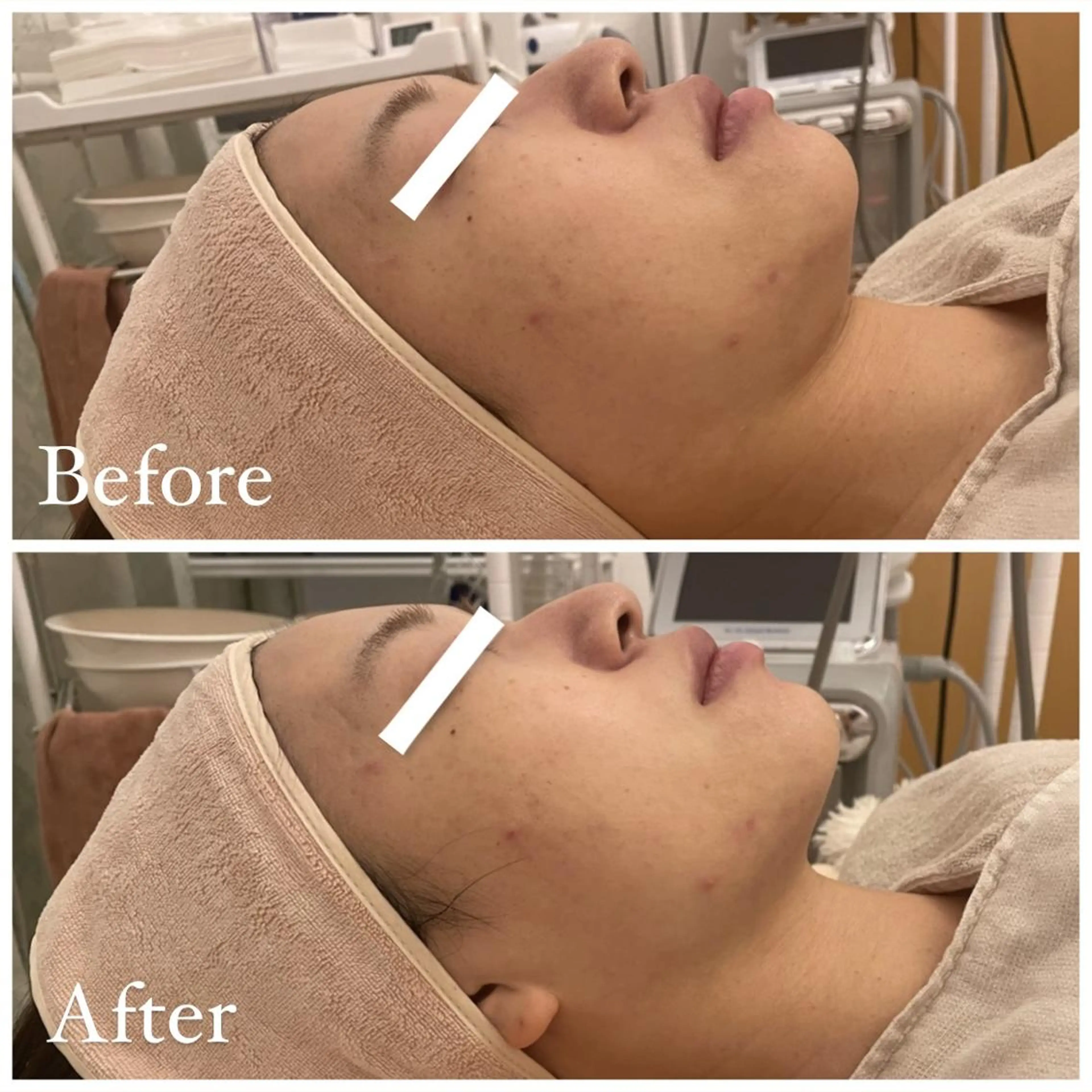 ✨美肌水光✨ アトリエリュバンのエステ・リラクイメージ