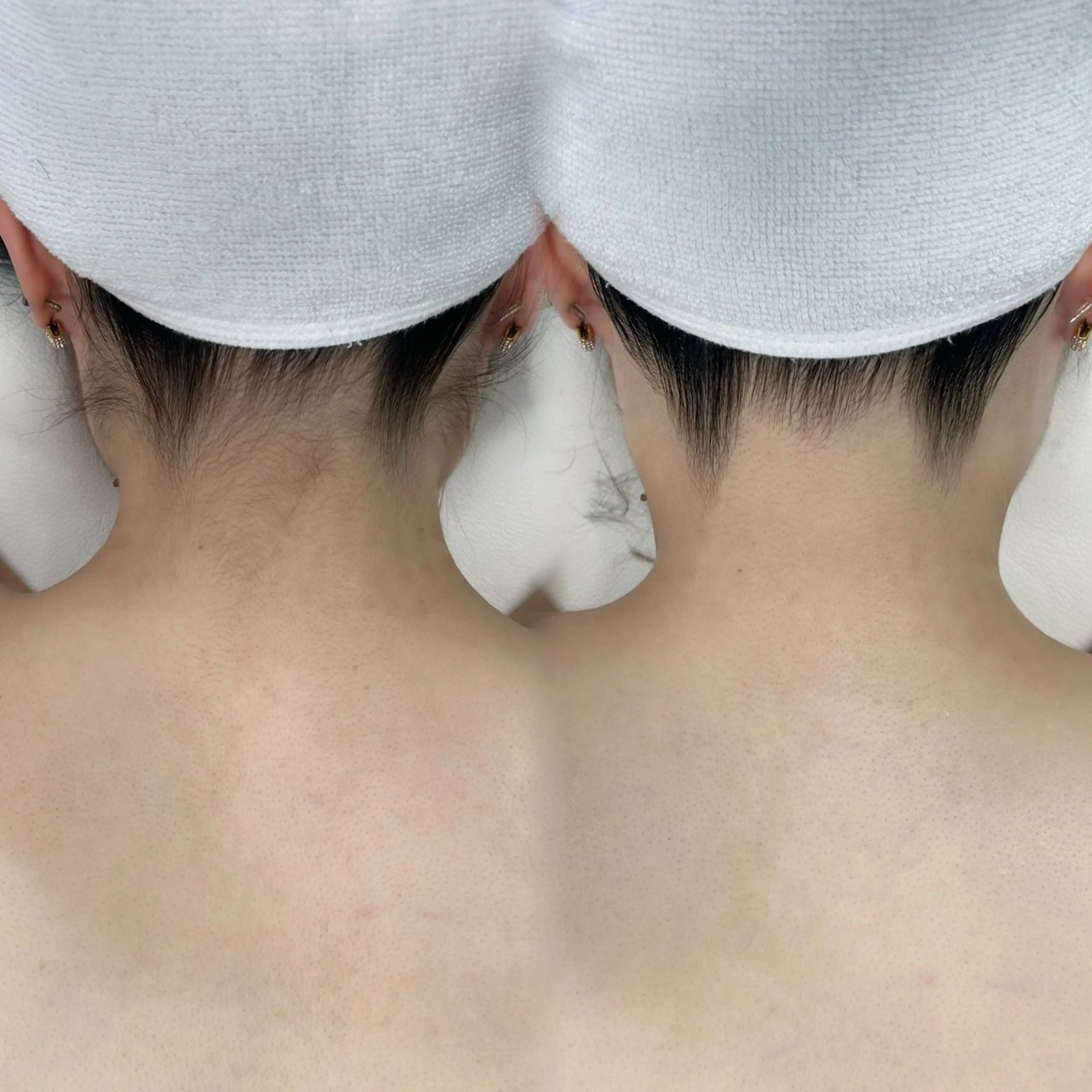 脱毛 かんな🤍 眉毛/脱毛の眉毛・アイブロウイメージ