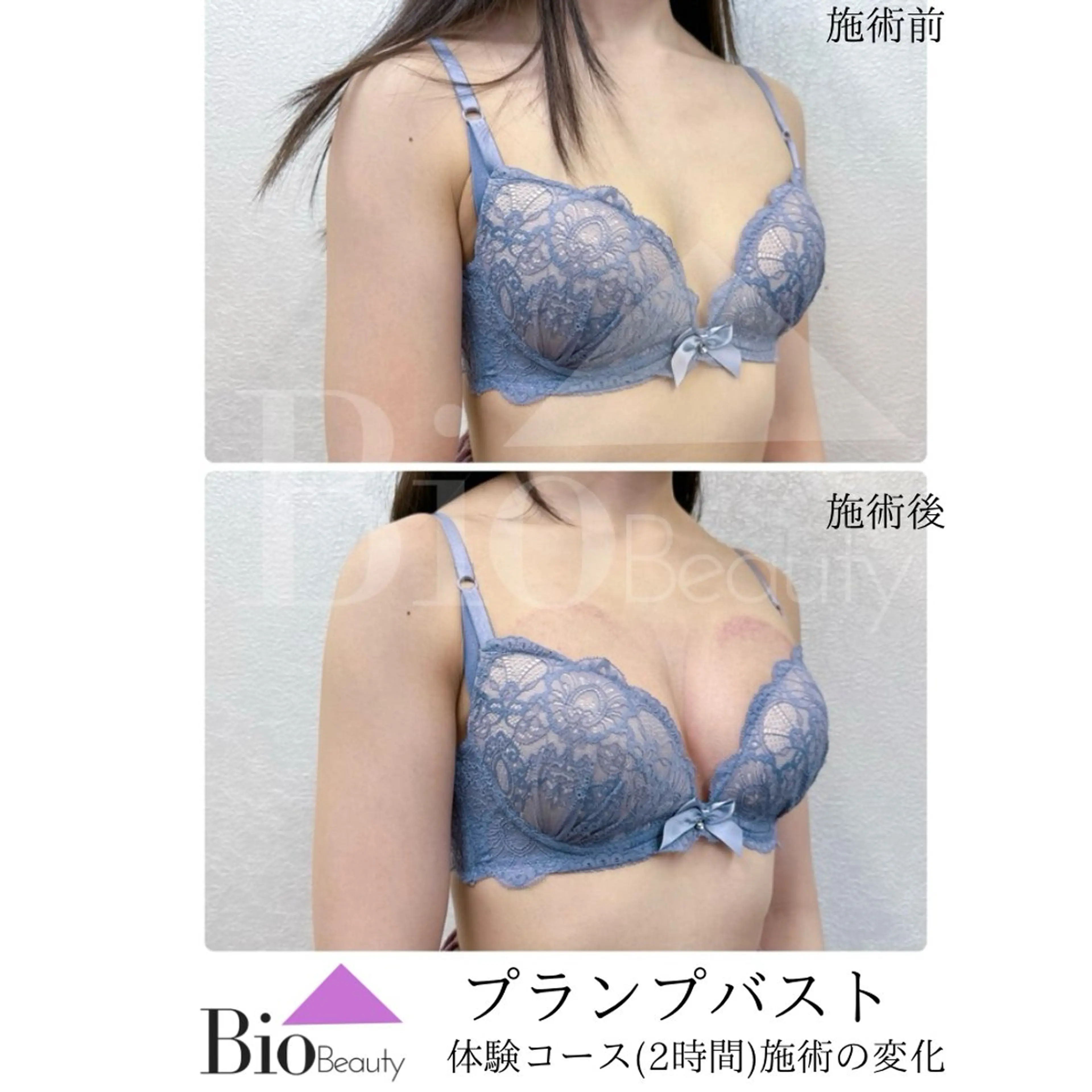 エステ Bio Beauty 神戸本店所属・エステ豊胸マイスター 中前のエステ・リラクイメージ